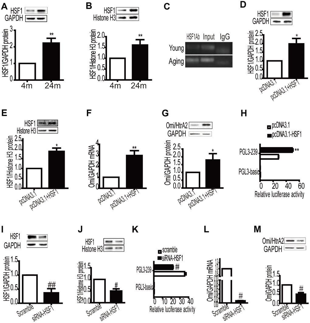 Overexpression of HSF1 in the myocardium promotes the expression of Omi mRNA and protein levels by enhancing the activity of the promoter of Omi/HtrA2. Total and nucleoprotein HSF1 expression was increased in aging myocardium, GAPDH, and histone H3 as internal control (A, B). Data are represented as mean +/- SEM. **Pvs. young, n = 6 per group. The binding of HSF1 to the Omi/HtrA2 promoter increased in aging mice ©. Total and nucleoprotein HSF1 expression increased after transient transfection of pcDNA3.1-HSF1 (D, E). mRNA and protein levels of Omi/HtrA2 increased after transient transfection of pcDNA3.1-HSF1 (F, G). Relative luciferase activity of PGL-239 increased after transient transfection of pcDNA3.1-HSF1 (H). Values are means ± SEM, *PPvs. pcDNA3.1, n = 3. Total and nucleoprotein HSF1 expression decreased after transient transfection of siRNA-HSF1 (I, J). Relative luciferase activity of PGL-239 decreased after transient transfection of siRNA -HSF1 (K). mRNA and protein levels of Omi/HtrA2 increased after transient transfection of pcDNA3.1-HSF1 (L, M), Values are means ± SEM, #P##Pvs. scramble, n = 3.