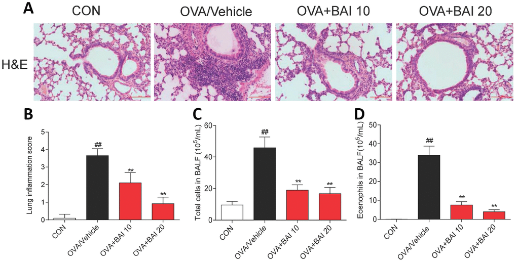 Baicalein suppresses OVA-induced inflammatory cell recruitment. (A) Histologic lung sections were stained with H&E, which showed that Baicalein reduces inflammatory cell recruitment and infiltration into the airway. Image are shown at 200× magnification with a scale bar representing 100 μm. (B) Lung inflammatory scores were assessed by histological analysis of lung tissues. Baicalein reduced the numbers of total cells (C) and eosinophils (D) in BALF following OVA challenge (Results are presented as the mean ± SEM. n = 6 mice per group; ##P *P **P 