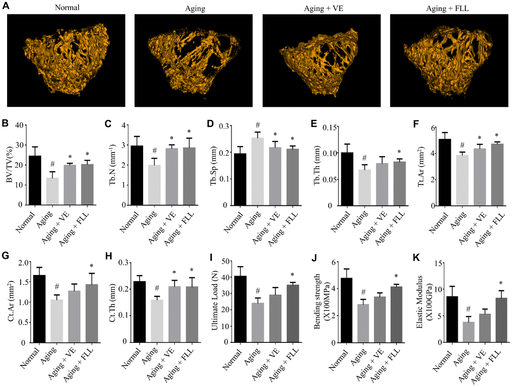 Fructus Ligustri Lucidi (FLL) preserves the bone microarchitecture and bone strength in the femurs of aging mice. Representative 3D reconstructions of trabecular images in the femoral metaphysis by micro(μ)-CT (A). μCT-derived quantification data of femoral metaphysis including BV/TV (%, B), Tb.N (1/mm) (C), Tb.Sp (mm) (D), Tb.Th (mm) (E), Tt.Ar (mm2) (F), Ct.Ar (mm2) (G), Ct.Th (mm, H). Three-point bending examination results including ultimate load (I), bending strength (X100MPa, J), and elastic modulus (X100GPa, K) in the femurs. Data are presented as mean ± SD. # compared with the normal group. * compared with the aging model group. p 