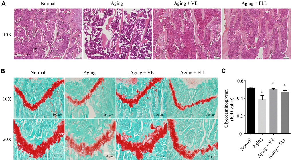 Fructus Ligustri Lucidi (FLL) preserves bone histomorphological features in aging mice. Representative images of H&E staining in the femoral metaphysis of different groups of mice (A). Safranin O/Fast green staining (B) and image analyses (C) in the femoral metaphysis of different groups of mice. Data are presented as mean ± SD. # compared with the normal group. * compared with the aging model group. p 