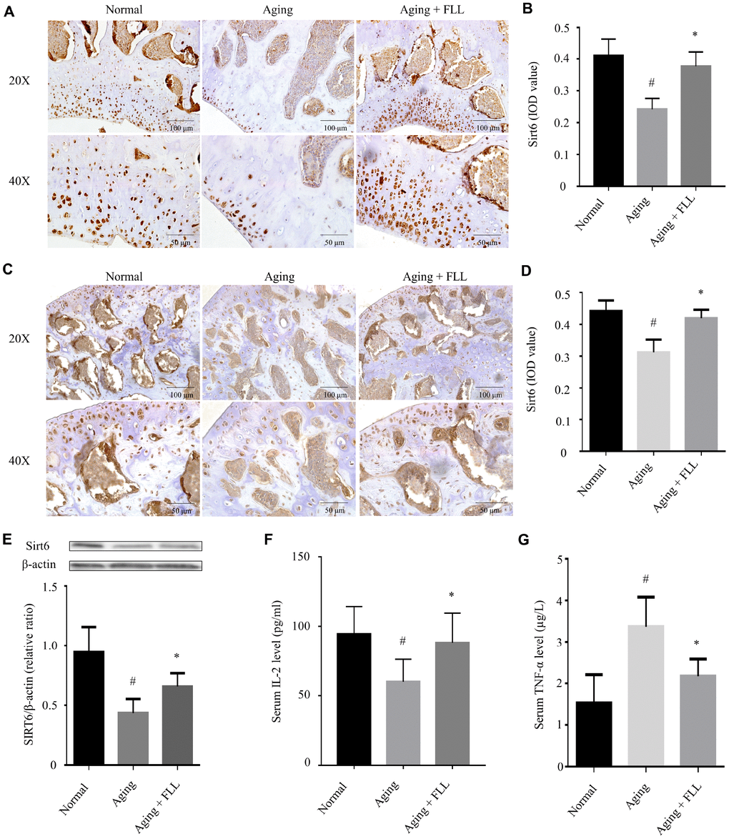 Fructus Ligustri Lucidi (FLL) increases tibial and femoral Sirt6 expression and regulates serum levels of TNF-α and IL-2 in aging mice. Immunohistochemical staining and western blot showed Sirt6 expression (original magnification, ×200, ×400) in the femoral metaphysis (A–B) and femoral heads (C–D), and in the tibias (E) of different groups of mice. Serum levels of IL-2 (F) and TNF-α (G). Data are presented as mean ± SD. # compared with the normal group. * compared with the aging model group. p 