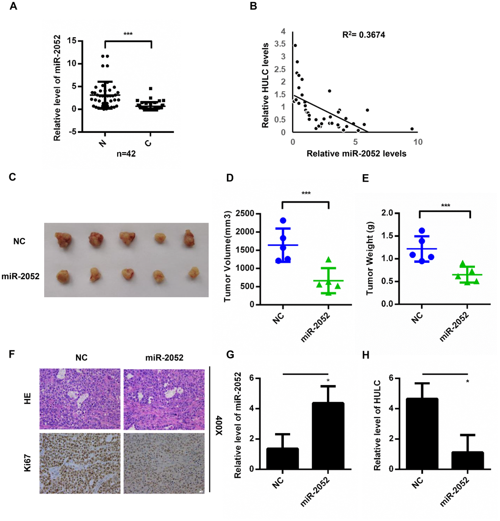 miR-2052 inhibits the proliferation, migration, and invasion of HCC cells in vitro and in vivo. (A) miR-2052 expression in HCC tissues analyzed by qPCR (n=42). (B) Correlation between HULC and miR-2052 expression in paired HCC tissues (n=42). (C–E) Tumor volume and weight measured in tissues from nude mice injected with miR-2052 stable HLF cells. (F) Ki67 levels measured by immunohistochemistry. (G, H) The expression of miR-2052 and HULC in xenograft tumors measured by qPCR. *P P 