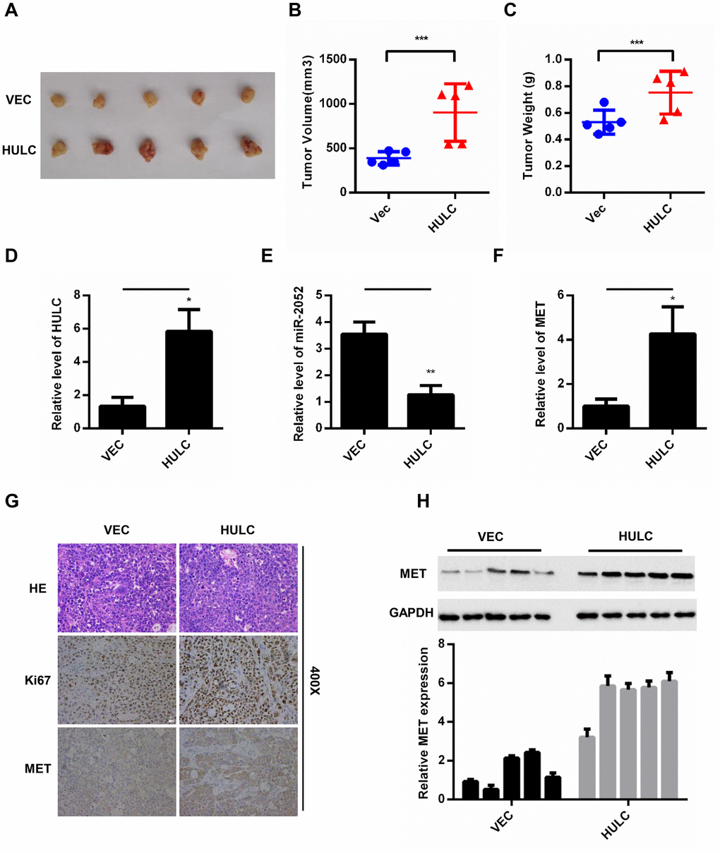 HULC promotes HCC growth through the miR-2052/MET axis in vivo. (A–C) Volume and weight measurements for tumors from nude mice injected with HLF cells stably overexpressing HULC. (D–F) Expression of HULC, miR-2052, and MET in tumor xenografts measured by qPCR. (G) Ki67 and MET levels measured by immunohistochemistry. (H) MET levels measured by western blot and gray level analysis. *P P P 