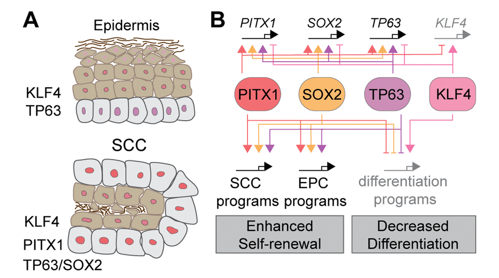 Bi-stable self-renewal and differentiation networks define SCC growth. (A) Stratified epithelia like epidermis express TP63 in proliferative basal, and KLF4 in post-mitotic, supra-basal cell layers. SCC formation coincides with de novo Pitx1 and Sox2 expression. PITX1 and SOX2 co-localize with TP63 in nuclei of basal TPCs, until their expression fades and KLF4 strengthens allowing TPCs to differentiate into SCC cells without proliferative potential. (B) The fate choice between TPC self-renewal and differentiation is governed by a bi-stable transcriptional network where PITX1, SOX2, and TP63 enhance each other’s transcription to drive self-renewal as they repress and are repressed by a KLF4 dependent squamous differentiation program.