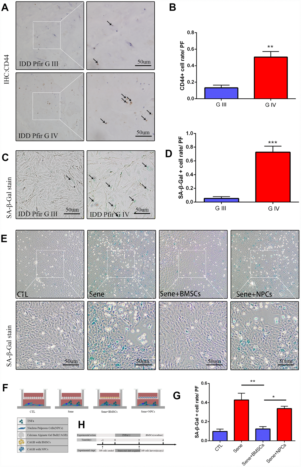 Mesenchymal stem cells activated in IDD, and cocultured BMSCs can alleviated the nucleus pulposus cells senescent rate in vitro. (A) Immunohistochemistry staining of CD44 in intervertebral disc degeneration of Pfirrman grade III(G III) and grade IV(G IV). n=5, Scale bar, 50um. (B) CD44 positive cell rate between G III and G IV were determined by using Image J software. (C) SA-β-Gal staining of primary NP cells of IDD Pfirrman grade IV and Pfirrman grade III. n=5, Scale bar, 50um. (D) SA-β-Gal positive cell rate between G III and G IV were determined by using Image J software. (E) 3D coculture models of were established as schematic diagram described. SA-β-Gal staining of senescent NP cells after 2 days coculture of normal NP cells +blank calcium alginate gel balls(CTL), senescent NP cells+ blank calcium alginate gel balls(Sene), senescent NP cells +calcium alginate gel balls with BMSCs(Sene +BMSCs), senescent NP cells +calcium alginate gel balls with normal NP cells(Sene +NPCs), n=3, Scale bar, 50um. (F) Co-cultivation pattern design and experimental groups. (G) SA-β-Gal positive cell rate between CTL, Sene, Sene +BMSCs and Sene +NPCs groups were determined by using Image J software. (H) Experimental flow diagram Values represent means±S.D. Significant differences between different groups are indicated as *P 