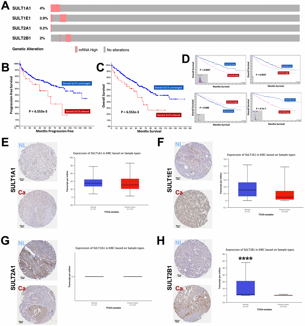 Overexpression of steroid SULT genes is associated with worsened prognosis in ccRCC. Reproduced from the TCGA KIRC dataset with cBioPortal platform, shown are (A) Percentage of ccRCC case with overexpression of steroid sulfotransferase (SULT) genes amongst 534 cases; (B–C) Progression-free and overall survival (OS) between ccRCC patients with steroid SULT genes upregulated and unchanged. Reproduced from TCGA KIRC dataset with Human Protein Atlas platform, shown are (D) OS of ccRCC patients with high or low mRNA level of SULT1A1, SULT1E1, SULT2A2 and SULT2B1 at automatically defined cutoffs. Reproduced from TCGA KIRC dataset with GEPIA and UALCAN platform, shown are (E–H) Contrast in gene expressions of steroid SULT genes between normal and cancer tissue, respectively (****P 