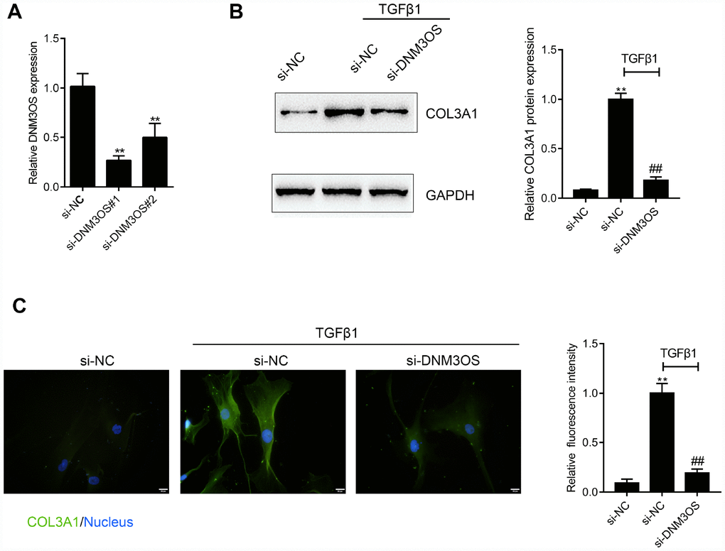 DNM3OS silencing decreases the protein level of COL3A1 (A) DNM3OS silencing conducted in PrSCs by transfection of si-DNM3OS#1 or si-DNM3OS#2 and confirmed by real-time PCR. PrSCs were transfected with si-DNM3OS in the presence or absence of TGFβ1 and examined for (B) the protein level of COL3A1 by Immunoblotting and (C) the protein content and distribution of COL3A1 by immunofluorescence (IF) staining (scale bar: 20 μM). *PPP
