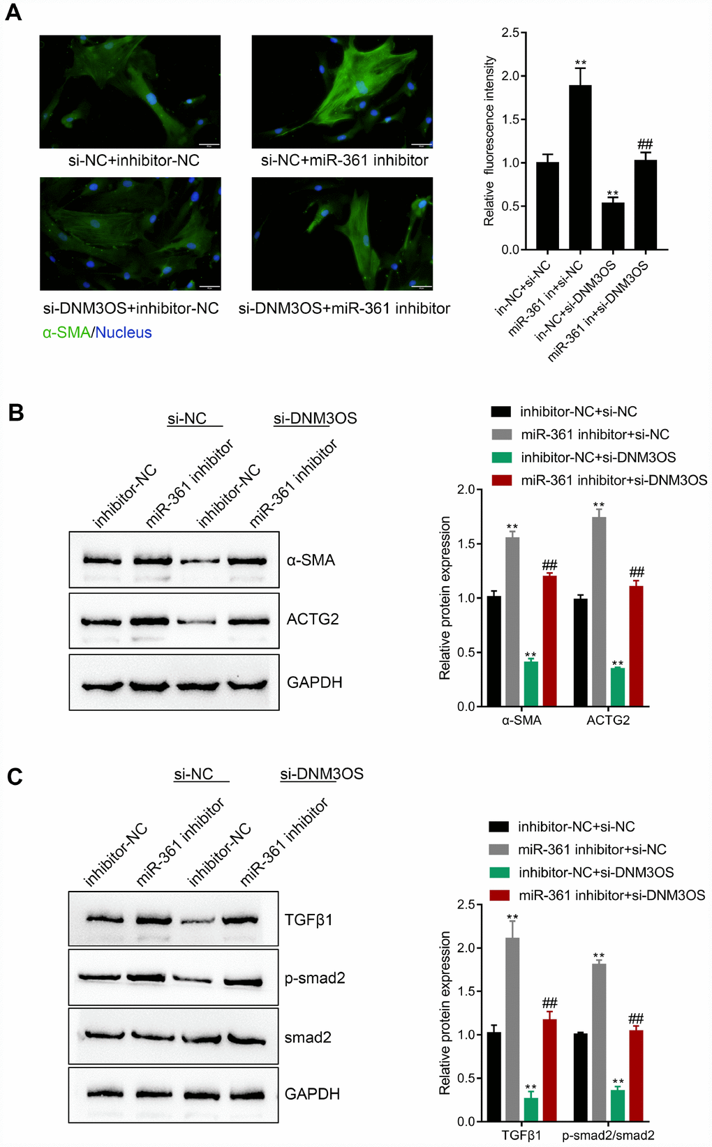 The dynamic effects of DNM3OS and miR-361 on TGFβ1 and downstream signaling PrSCs were cotransfected with si-DNM3OS and miR-361 inhibitor and examined for (A) the protein content and distribution of α-SMA by IF staining (scale bar: 50 μM); (B) the protein levels of α-SMA and ACTG2 by immunoblotting and (C) the protein levels of TGFβ1, p-Smad2, and Smad2 by immunoblotting.