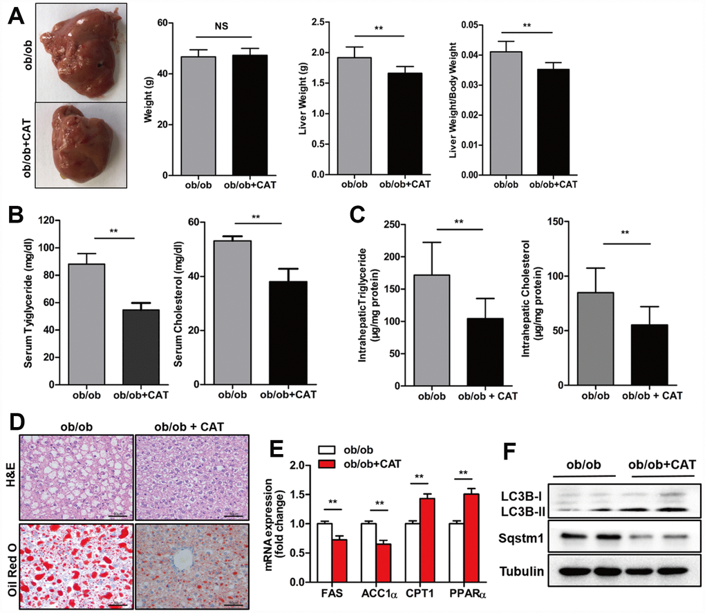 CAT ameliorated hepatic steatosis in ob/ob mice. Eight week-old ob/ob mice were treated with CAT (50 mg/kg/d) or vehicle by oral gavage for 4 weeks. (A) Gross images of liver tissue and changes in liver and body weights. (B) Serum TG and TC levels. (C) Liver TG and TC content normalized to total protein. (D) Representative photomicrographs of liver sections stained with H&E and Oil Red O. Scale bars: 50 μm. (E) mRNA expression levels of hepatic lipogenic genes ACC1α and FAS and fatty acid oxidation genes PPARα and CPT1. Data are expressed as fold-change relative to vehicle-treated ob/ob mice. (F) Representative western blot analysis of LC3-II, Sqstm1/P62, and Becn1 proteins. Unpaired two-sided t-tests were used for statistical comparisons to controls. *P **P ***P 