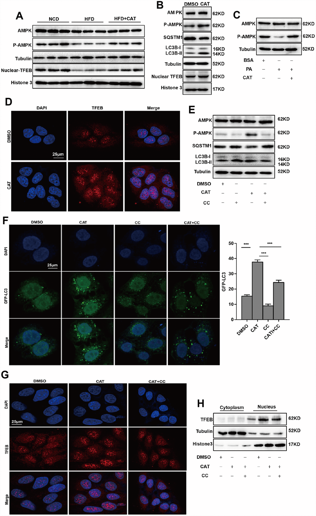 CAT induced autophagy via the AMPK-TFEB pathway. (A) Immunoblot detection of TFEB, AMPK, and AMPK phosphorylation levels in livers of mice. (B) Immunoblot detection of LC3-II, SQSTM1, TFEB, AMPK, and AMPK phosphorylation levels in HepG2 cells treated with CAT (10 μg/mL) for 24 h. (C) Immunoblot analysis of AMPK and p-AMPK levels in HepG2 cells treated with 0.3 mM palmitate (PA) and 10 μg/mL CAT for 24 h. (D) Fluorescence microscopy images of nuclear TFEB in HepG2 cells treated with 10 μg/mL CAT for 24 h. Scale bars: 25 μm. (E) Immunoblots of LC3-II, SQSTM1, AMPK, and AMPK phosphorylation in HepG2 cells treated with CAT (10 μg/mL) and Compound C (CC, 10 μM) for 24 h. (F) Numbers of GFP-LC3 in HepG2 cells expressing GFP-LC3 after treatment with or without CAT (10 μg/mL) and CC (10 μM) for 24 h were evaluated using fluorescence microscopy. Scale bars: 25 μm. (G, H) Fluorescence microscopy images and Immunoblot analysis of nuclear TFEB in HepG2 cells treated with 10 μg/mL CAT and Compound C (CC, 10 μM) for 24 h. Scale bars: 25 μm. ***P 