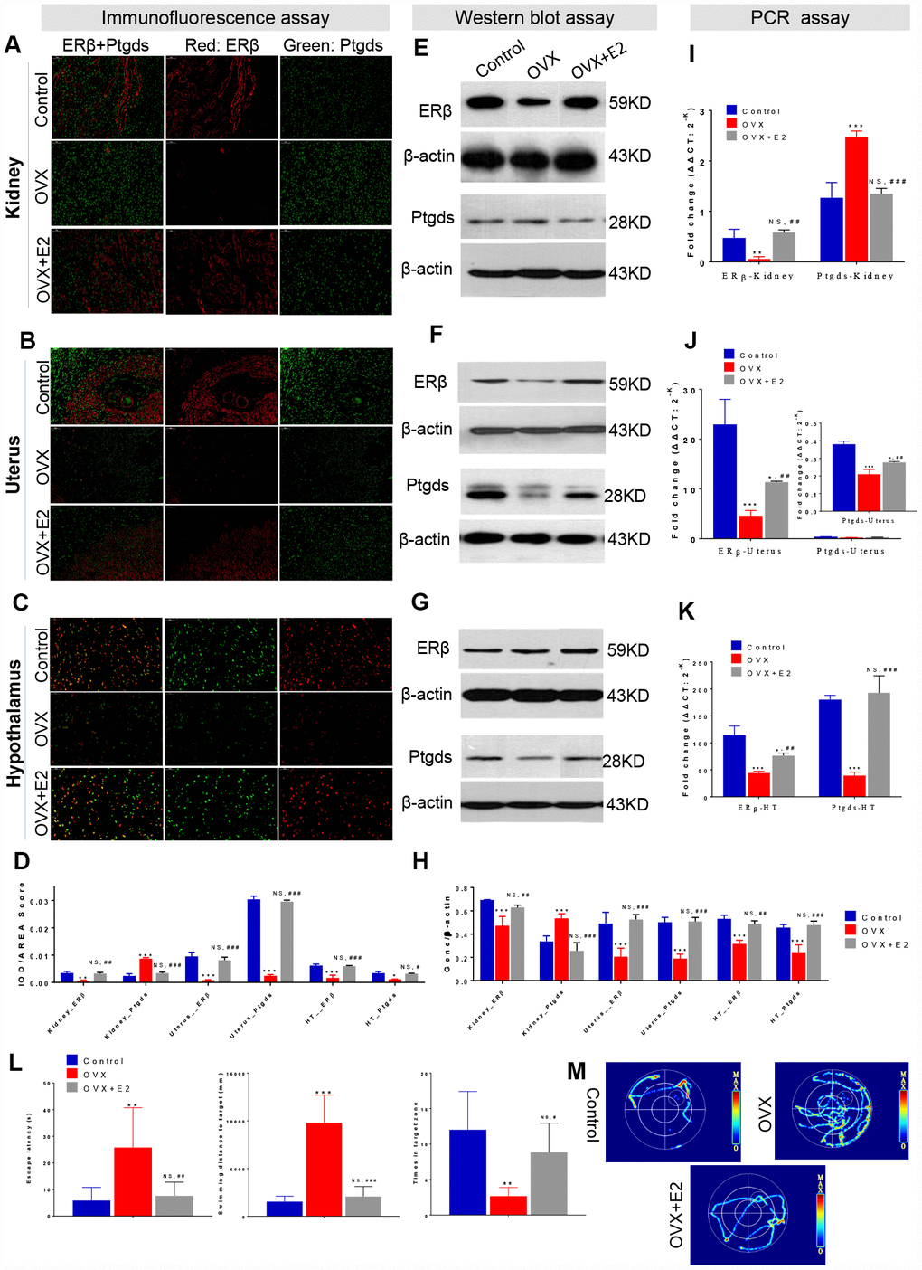 ER-depletion reduce HUK functions attribute to ERβ/Ptgds signalling pathway disturbance. Immunofluorescence (IF) analysis including the staining images (A–C) and AOD calculation data (D) in the left panel shows the double staining of ERβ (red) and Ptgds (green) from kidney (A), uterine (B), and hypothalamic (C) among control, OVX, and E2+OVX rats. Scale bar, 50 μM. The AOD ratio indicates the ratio of optical density (IOD) and values to staining area (AREA). Western blot (WB) analysis including the gel images (E–F) and protein loading data (H) in the middle panel present the ERβ and Ptgds proteins expression from kidney (E), uterine (F), and hypothalamic (G) among control, OVX, and E2+OVX rats. n=3, mean ± s.e.m. Real time PCR analysis of the transcription levels of ERβ and Ptgds expression various among control, OVX and OVX+E2 rats along ‘hypothalamus-uterus-kidney axis’ in the right panel (I–K). n=3, mean ± s.e.m., NS, not significant. Morris water maze test including location test and spatial learning test for control, OVX, and E2+OVX rats. As well as (L) escape latency duration, swimming length to the escape platform, number of crossings escape platform position, and (M) the images of total movement towards to the target for control, OVX, and E2+OVX rats. n=6, mean ± s.d., *p versus control rats, NS, not significant.