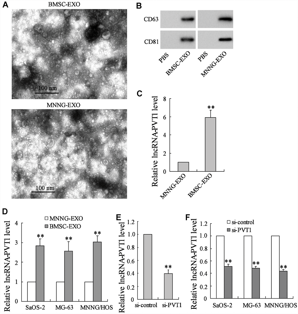 BMSC-derived exosomes transport lncRNA PVT1 into osteosarcoma cells. The BMSC-derived exosomes (BMSC-EXO) and the osteosarcoma cell MNNG/HOS-derived exosomes (MNNG-EXO) in the culture medium were respectively isolated. (A) They were observed under the transmission electron microscopy. (B) The expression of CD81 and CD63 proteins, both of which were exosome markers, was detected using western blot analysis. (C) The expression of PVT1 was detected using qRT-PCR. The osteosarcoma cell lines, including Saos-2, MG-63, and MNNG/HOS, were co-cultured with 40 μg/mL BMSC-EXO or MNNG-EXO for 48 h. (D) The expression of PVT1 in osteosarcoma cells. (E) BMSCs were transfected with si-PVT1 for 48 h. The expression of PVT1 in exosomes which were isolated from PVT1-interfering BMSCs was detected. (F) The expression of PVT1 in osteosarcoma cells, which were co-cultured with BMSC-EXOsi-PVT1 or BMSC-EXOsi-control for 48 h. Three independent experiments. **p