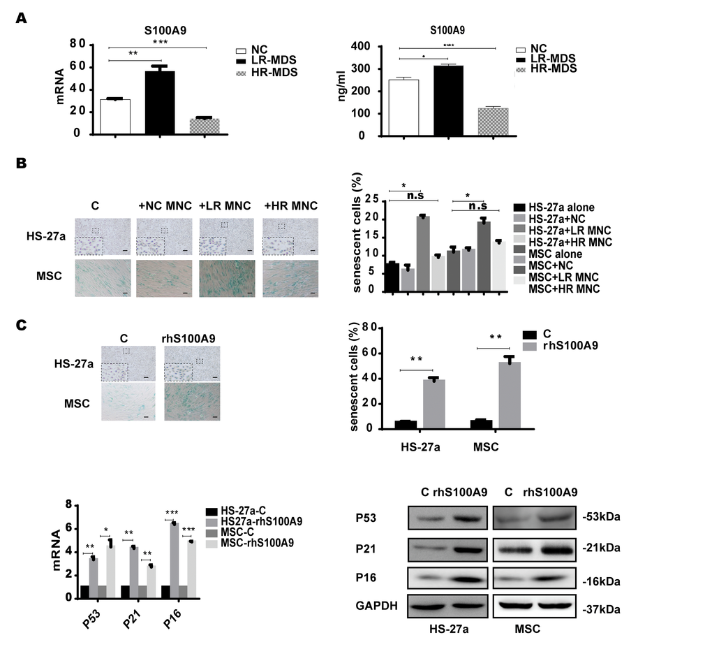 S100A9 induces cellular senescence in bone marrow stromal cells. (A) S100A9 expression in BM-MNCs isolated from MDS patient specimens (n = 19 LR-MDS, and n = 13 HR-MDS) compared with the expression in normal control BM-MNCs (n =20) as determined with qPCR (left). S100A9 levels in bone marrow supernatant from MDS patient specimens (n = 16 LR-MDS, and n = 8 HR-MDS) compared with the levels in normal BM-MNCs (n =10) as measured with ELISA (right). (B) HS-27a cells and MSCs were co-cultured with normal control BM-MNCs and MDS BM-MNCs. Senescent cells (green) were tested after 72 h. The number of senescent cells from at least 500 cells in 10 randomly chosen fields was used to calculate their percentage (40 × magnification). (C) Cells were treated with rhS100A9 (200 ng/ml for HS-27a, 500 ng/ml for MSC) for 72h. Subsequently, senescent cells were counted and presented in graphs (40 × magnification). Finally, p53, p21, and p16 levels were measured using qPCR and western blot. Data are expressed as mean ± SD from three experiments. *P