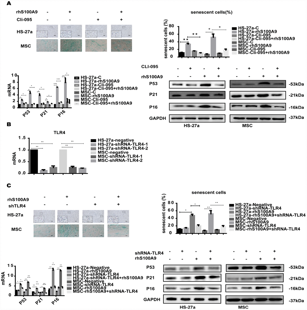 TLR4 is required for S100A9-induced cellular senescence. (A) Cells were pretreated with CLI-095 (1 μg/ml) for 2 h and then treated with rhS100A9 for 72h. Senescent cells were counted and presented in graphs (40 × magnification). The expression of p53, p21, and p16 was measured using qPCR and western blot. (B) The RNAi efficiency of TLR4 was assayed utilizing qPCR. (C) TLR4 was knocked down, and cells were treated with rhS100A9 for 72h. Senescent cells were counted and presented in graphs (40 × magnification). Next, p53, p21, and p16 levels were measured utilizing qPCR and western blot. Data are expressed as mean ± SD from three experiments. *P