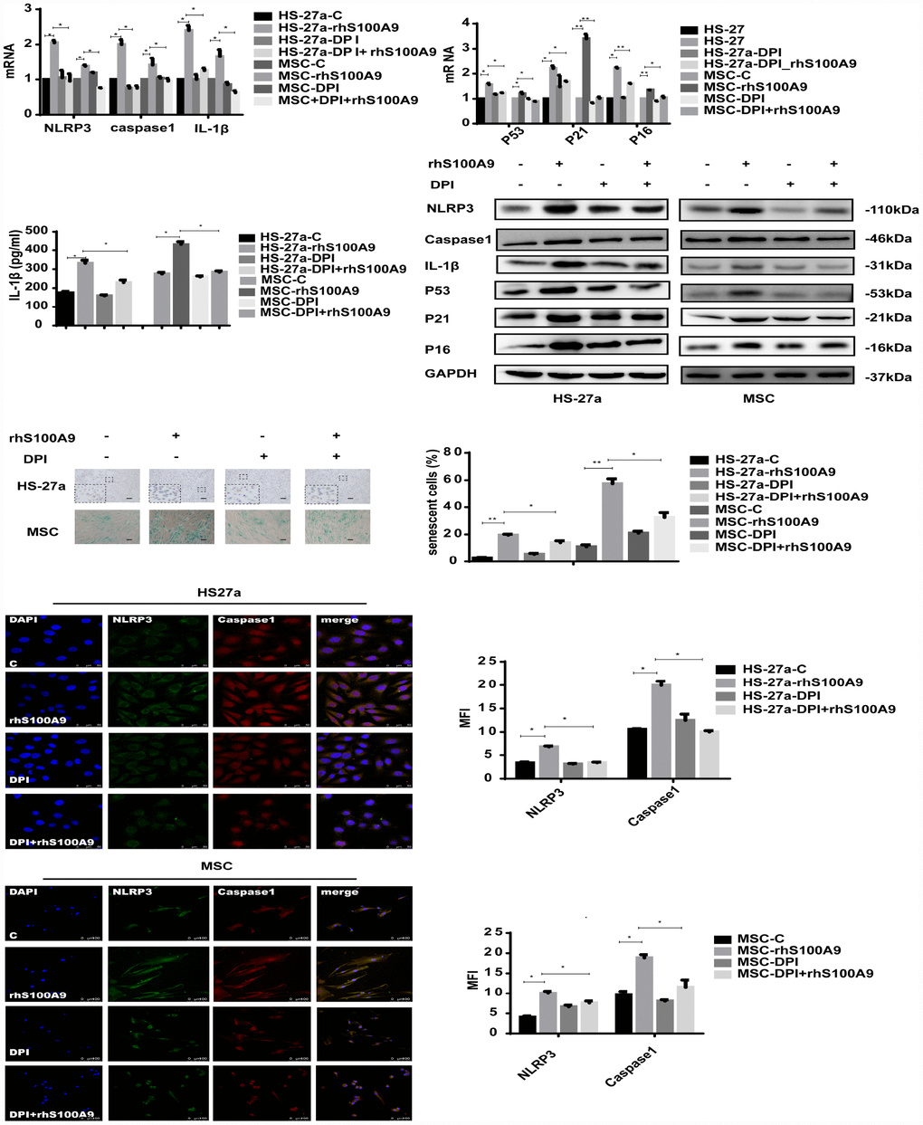 S100A9-induced cellular senescence, NLRP3 inflammasome formation, and IL-1β secretion require ROS. Cells were pretreated with DPI for 2 h and then treated with S100A9 for 72h. NLRP3, Caspase-1, IL-1β, p53, p21, and p16 expression was tested using qPCR and western blot. IL-1β secretion was measured utilizing ELISA. Senescent cells were counted and presented in graphs (40×magnification). Representative confocal fluorescence micrograph of Caspase-1 and NLRP3 expression (scale bars: HS-27a 50 μm and MSC 100 μm). Data are expressed as mean ± SD from three experiments. *P