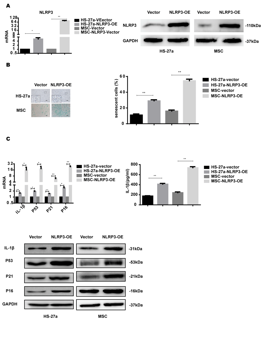 NLRP3 overexpression induces IL-1β secretion and cellular senescence. (A) The efficiency of NLRP3 overexpression was assayed with qPCR and western blot. (B) Senescent cells were counted and visualized in graphs (40 × magnification). The levels of p53, p21, p16, and IL-1β were measured by qPCR and western blot. Data are expressed as mean ± SD from three experiments. *P