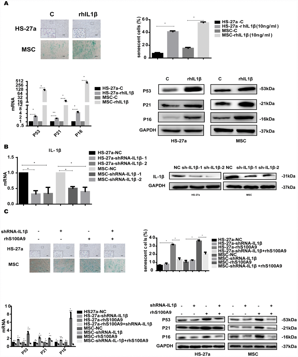 IL-1β is sufficient to induce cellular senescence. (A) Cells were treated with rhIL-1β (10 ng/ml) for 72h. Next, senescent cells were counted and presented in graphs (40 × magnification). The levels of p53, p21, and p16 were measured using qPCR and western blot. (B) RNAi efficiency of IL-1β was assayed utilizing qPCR and western blot. (C) IL-1β was knocked down, and cells were treated with S100A9 for 72h, senescent cells were counted and presented in graphs (40 × magnification). The expression of p53, p21 and p16 was determined using qPCR and western blot. Data are expressed as mean ± SD of three experiments. *P