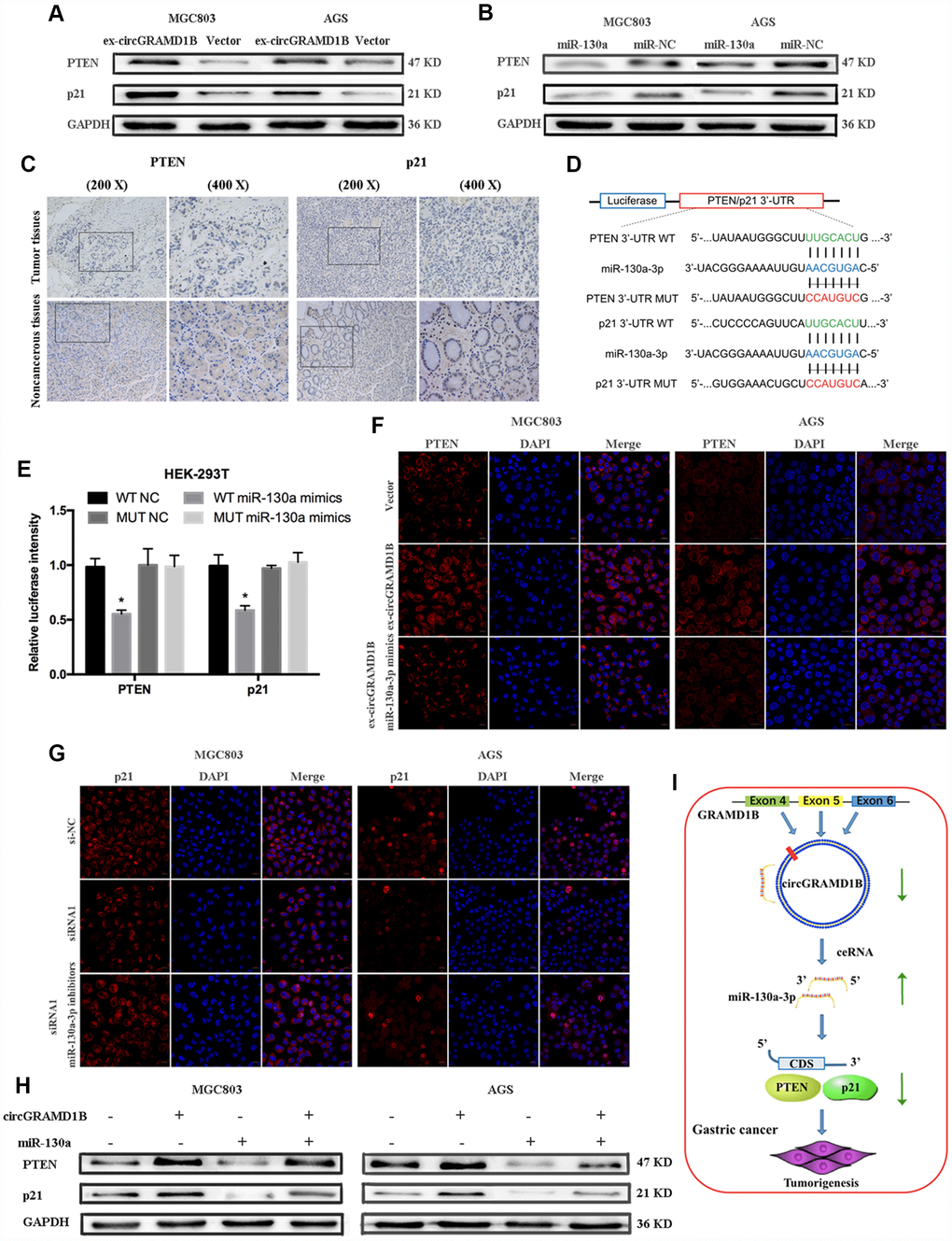 circGRAMD1B inhibits the proliferation and invasion of GC cells by modulating miR-130a-3p/PTEN/p21 axis. (A) Western blot assays showed that circGRAMD1B upregulated the protein expression levels of PTEN and p21 in transfected MGC803 and AGS cells. (B) Western blot assays showed that miR-130a-3p decreased the protein expression levels of PTEN and p21 in transfected MGC803 and AGS cells. (C) PTEN and p21 expression was detected via IHC in GC tissues and paired noncancerous tissues. (D) Schematic illustration of PTEN/p21 -3′ UTR-WT and -3′ UTR-MUT luciferase reporter vectors. (E) Luciferase reporter assays demonstrated that PTEN and p21 are direct targets of miR-130a-3p mimics. (F–G) Relative protein expression level of PTEN and p21 were assessed by IF after GC cells transfected with circGRAMD1B-overexpressing plasmid or the silencing siRNA1, and miR-130a-3p mimics or inhibitors. (H) Western blot assays showed that miR-130a-3p could partly decrease the protein expression levels of PTEN and p21, which were promoted by circGRAMD1B. (I) Schematic diagram of the regulatory mechanism of circGRAMD1B/ miR-130a-3p/ PTEN/p21 axis in the inhibition of GC progression. (Values are shown as the mean ± standard error of the mean based on three independent experiments. *P 