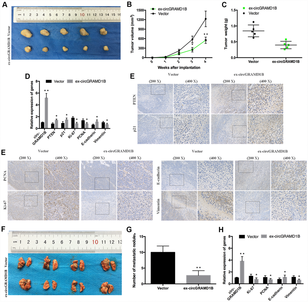 circGRAMD1B inhibits GC growth and metastasis in vivo. (A) Representative images of xenograft tumors induced by circGRAMD1B overexpressing vector and control vector-transfected MGC803 cells (five mice per group). (B) A growth curve of the tumor growth in circGRAMD1B overexpressing vector and control vector-transfected MGC803 cells. (C) Tumor weights of the xenograft tumors in circGRAMD1B overexpressing vector and control vector-transfected MGC803 cells. (D) Expressions levels of circGRAMD1B, PTEN, p21, Ki-67, PCNA, E-cadherin, and Vimentin in xenograft tumors were determined by qRT-PCR assays. (E) Expression levels of PTEN, p21, Ki-67, PCNA, E-cadherin, and Vimentin were shown by IHC staining in representative xenograft tumors. (F) Representative images of lung metastatic nodules in the circGRAMD1B overexpression group and control group are indicated by white arrows. (G) The number of tumor nodules on lung surfaces from the circGRAMD1B overexpression group and control group. (H) qRT-PCR was used to detect the expression levels of circGRAMD1B, Ki-67, PCNA, E-cadherin, and Vimentin in lung metastasis from nude mice in the circGRAMD1B overexpressing group and control group. (Values are shown as the mean ± standard error of the mean based on three independent experiments. *P 