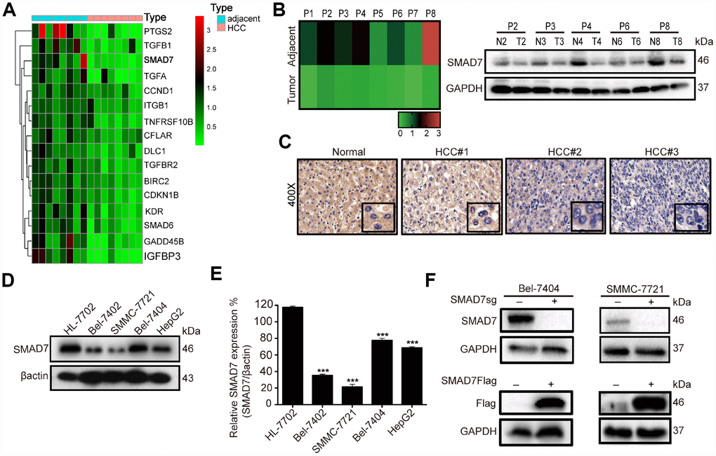 SMAD7 is downregulated in liver cancer tissues and cell lines. (A) Microarray analysis of gene expression from RNA extracted in 8 paired human liver cancer tissues and matched normal liver tissues. (B) RT-qPCR assay detected the mRNA expression level of SMAD7 in 8 paired human liver cancer tissues (left panel). Western blot assay detected the protein expression level of SMAD7 in 5 paired liver cancer tissues which SMAD7 were differentially expressed (right panel). (C) Representative IHC images of SMAD7 staining in normal liver tissues and liver cancer tissues at 400Χ magnifications. (D) The SMAD7 protein level was analyzed in normal human liver cell line HL-7702 and liver cancer cell lines Bel-7402, SMMC-7721, Bel-7404 and HepG2 by western bolt assay. β-actin served as loading control. (E) Relative SMAD7 protein expression was calculated by the ration of SMAD7/β-actin in different cell lines from three independent tests. ***pF) The protein expression of SMAD7 in Bel-7404 and SMMC-7721 were analyzed by western blot with or without SMAD7-Flag or SMAD7-sgRNA virus infection. β-actin served as loading control.