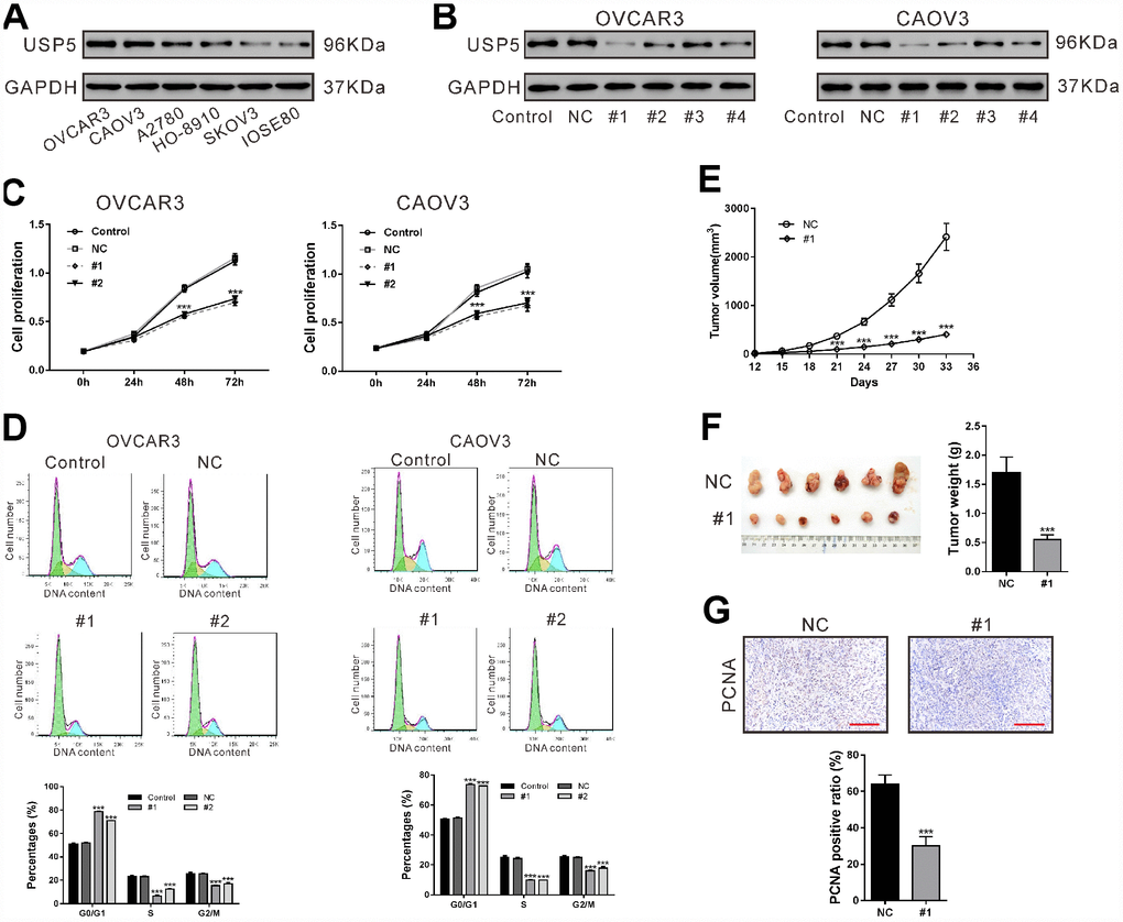 Down-regulation of USP5 inhibited cell proliferation and cell cycle progression of ovarian cancer cells. (A) Western blotting analysis of USP5 in 5 ovarian cancer cell lines and a normal human ovarian cell line IOSE80. (B) OVCAR3 and CAOV3 cells were transiently infected with USP5 shRNAs (#1, #2, #3 and #4), control shRNA (NC) or untreated (Control). Western blotting analysis was performed to check the knockdown efficiency of USP5 shRNAs. (C) Proliferation of OVCAR3 and CAOV3 cells expressing NC or USP5 shRNAs (#1, #2) was detected at the indicated time points by CCK-8 assay. (D) Cell cycle distribution of OVCAR3 and CAOV3 was assessed at 48 h after virus infection by PI staining and flow cytometry analysis. Representative graphs and statistical analysis of percentages at different cell cycle stages are shown. (E–G) Nude mice were transplanted with OVCAR3 cells expressing control (NC) or USP5 shRNA (#1). (E) Tumor volume was assessed at the indicated time points in both group (n=6 per group). (F) On 33 days after transplantation, tumors were resected and weighed. (G) Immunohistochemistry staining of PCNA in xenografts. Scale bar: 100 μm. Representative images and statistical analysis of percentages are shown. ***P