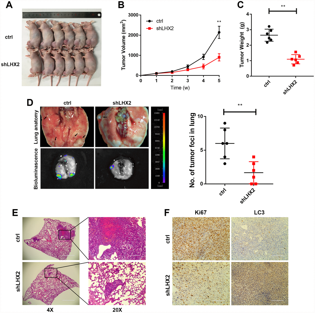 LHX2 silencing inhibits OS growth and metastasis in vivo. (A) OS-143B cells stably expressing luciferase and the indicated genes were inoculated into nude mice (n=6), and mice were sacrificed after 5 weeks. (B) Tumor sizes were measured weekly and calculated using the following formula: V= (Length×Width2/2). (C) Orthotopic tumors were dissected and weighted. **PD) Representative bioluminescence and lung anatomy of the metastasis of OS cells, black arrows indicate possible metastatic lesions. Metastatic foci in the lungs were determined by luminescence signals and counted. **PE) Representative H&E staining of lung sections. (F) IHC analysis of Ki67 and LC3 in tumors from tumor-bearing mice. Scale bar: 100 μm.