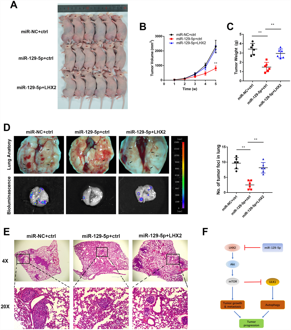 Restoration of LHX2 reverses miR-129-5p overexpression-mediated malignant phenotypes in vivo. (A) OS-143B cells stably expressed luciferase and the indicated gene were inoculated into nude mice (n=6), which were sacrificed 5 weeks later (B) Tumor sizes were measured weekly and calculated using the following formula: V= (Length×Width2/2). (C) Orthotopic tumors were dissected and weighted. **PD) Representative bioluminescence and lung anatomy images of metastatic OS cells. Black arrows indicate possible metastatic lesions. Metastatic foci in lung were determined by luminescence signals and counted. **PE) Representative H&E stained lung sections. (F) Working model of the miR-129-5p/LHX2/mTOR axis in OS.