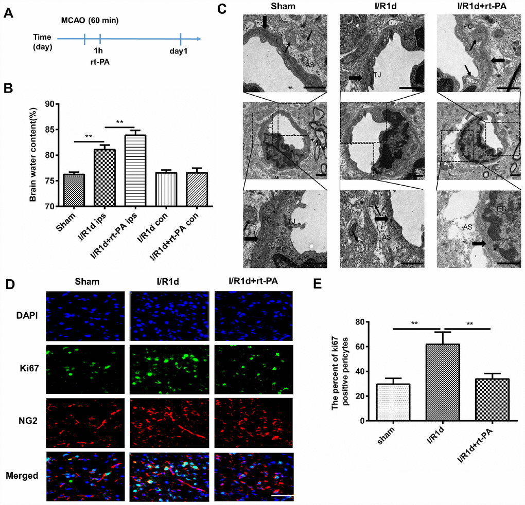 Rt-PA treatment disrupted the BBB in vivo after I/R. (A) Schematic of the animal study design. (B) Water content of the ipsilateral hemispheres and contralateral hemispheres of the brains of mice treated with or without 9 mg/kg rt-PA 1 d after I/R; ips: ipsilateral hemisphere; con: contralateral hemisphere; n = 6 for each group. Data represent the mean ± sd; *p p C) Electron microscopy was used to study the BBB ultrastructure of the sham-treated mice and mice 1 d after I/R treatment with or without 9 mg/kg rt-PA; scale bar: 4 μm. PC: pericyte, EC: endothelial cell; As: astrocyte; TJ: tight junction. The thin arrow indicates mitochondria; the thick arrow indicates the basement membrane. (D, E) Representative immunofluorescence images of Ki-67 protein expression in the pericytes of the sham-treated mice and mice 1 d after I/R treatment with or without 9 mg/kg rt-PA; scale bar: 50 μm; n = 3 for each group. Data represent the mean ± sd *p p 