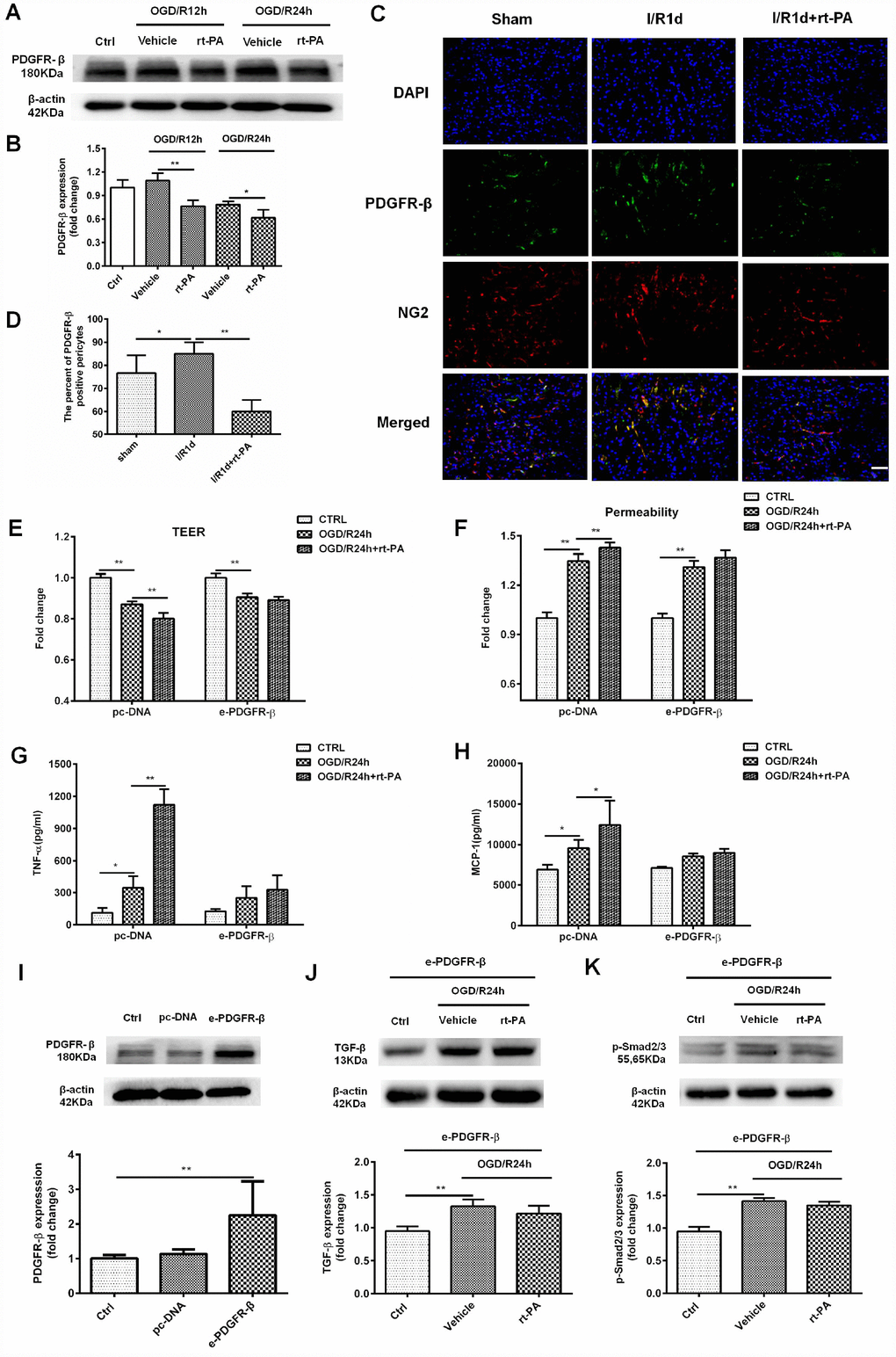 PDGFR-β mediated the disruption of the BBB after rt-PA treatment. (A, B) Representative western blot showing the expression of PDGFR-β 12 h and 24 h after treatment with or without 50 μg/ml rt-PA following OGD for 4 h. Densitometric analysis showing that the level of PDGFR-β protein 12 h and 24 h after treatment with or without rt-PA after OGD for 4 h; n = 3 for each group. Data represent the mean ± sd, *p p C, D) Immunofluorescence was used to detect the expression of PDGFR-β in the sham-treated mice and mice treated with or without 9 mg/kg rt-PA 1 d after I/R; scale bar: 50 μm; n = 3 for each group. Data represent the mean ± sd, *p p E, F) The TEER and permeability were measured in the pc-DNA- or e-PDGFR-β-transfected pericytes cocultured with endothelial cells alone or in the presence of 50 μg/ml rt-PA 24 h after OGD/R; n = 3–5 for each group. Data represent the mean ± sd, *p p G, H) The concentrations of TNF-α and MCP-1 were measured in pc-DNA- or m-PDGFR-β-transfected pericytes cocultured with endothelial cells alone or in the presence of 50 μg/ml rt-PA 24 h after OGD/R; n = 3 for each group. Data represent the mean ± sd, *p p I) The expression of PDGFR-β in the control, pc-DNA-, and m-PDGFR-β-transfected pericytes was determined by western blotting; n = 3 for each group. Data represent the mean ± sd, *p p J, K) The expression of TGF-β and p-Smad2/3 was measured in PDGFR-β-overexpressing pericytes treated with or without 50 μg/ml rt-PA 24 h after OGD/R; n = 3 for each group. Data represent the mean ± sd, *p p 