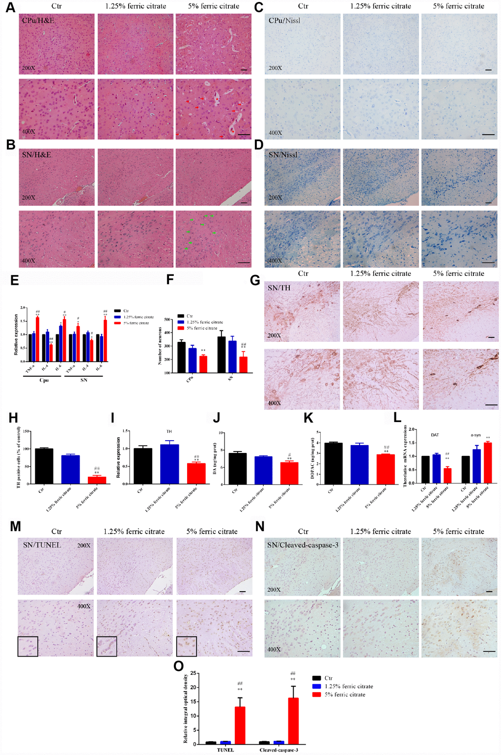 Iron overload induced by ferric citrate supplementation causes neurotoxicity in the SN and CPu. (A and B) Representative images of H&E staining display the histopathological damage in the CPu and SN induced by ferric citrate supplementation. Red arrows show white matter edema, red stars show vasodilatation, and green arrows display nerve cell swelling. (C, D and F) Representative images and quantification of NISSL staining display the decreased numbers of neurons in ferric citrate-supplemented mice. Error bars indicate SD. (E) qRT-PCR showed increased mRNA levels of TNF-α and IL-6 and decreased expression of IL-4 in the Cpu and SN of mice supplemented with ferric citrate (N=5). Error bars indicate SEM. (G and H) Representative images and quantification of TH staining display decreased numbers of dopaminergic neurons in the SN of mice supplemented with ferric citrate. Error bars indicate SD. (I) qRT-PCR shows decreased mRNA levels of TH in the SN of mice supplemented with ferric citrate (N=5). Error bars indicate SEM. (J and K) Quantifications show the decreased levels of DA and DOPAC in mice supplemented with ferric citrate. Error bars indicate SEM. (L) qRT-PCR show the mRNA levels of DAT and a-syn in the SN of mice supplemented with ferric citrate (N=5). Error bars indicate SEM. (M to O) Representative images and quantification from TUNEL and cleaved caspase-3 staining display the increased neuronal apoptosis in the SN of mice supplemented with ferric citrate. Bars, 100 μm. Compared with the Ctr group, *p#p##p