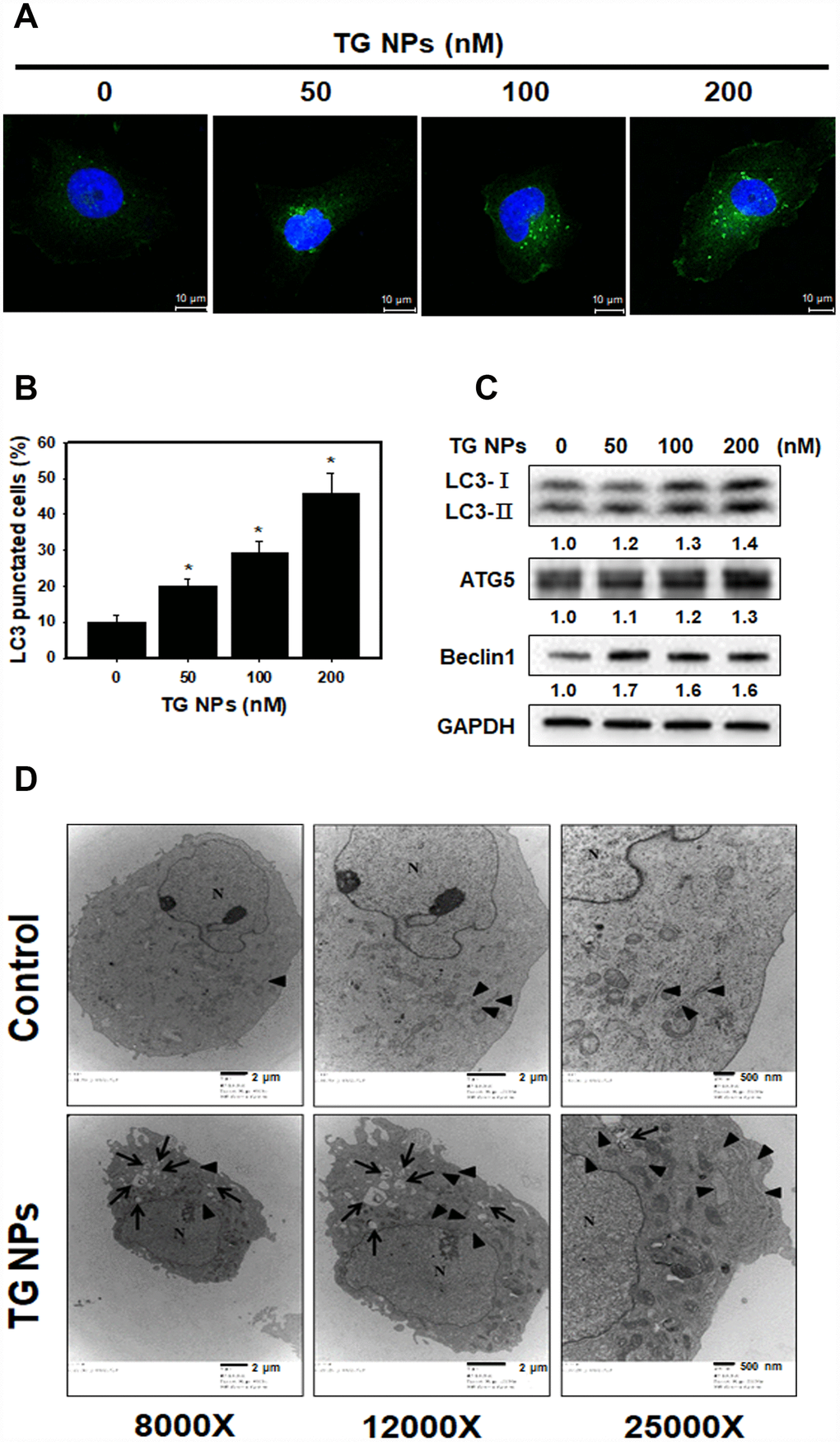 TG NPs induce autophagy in HK-2 cells. (A) The immunofluorescence staining for the LC3 protein in HK-2 cells treated with the TG NPs was observed using confocal microscopy. LC3 was detected with DyLight™ 488-conjugated secondary antibodies (green), and nuclei were stained with DAPI (blue). (B) Quantitative data calculating the number of LC3 dots are shown. Cells were treated with TG NPs for 24 h. *p C) Autophagy-related protein expression was measured by western blotting. Cells were treated with different concentrations of the TG NPs for 24 h. (D) Cell ultrastructure was observed using TEM. Cells were treated with TG NPs (100 nM) for 24 h. The arrows indicate autophagosomes and autolysosomes. The arrowheads indicate the ER. N indicates the nucleus.