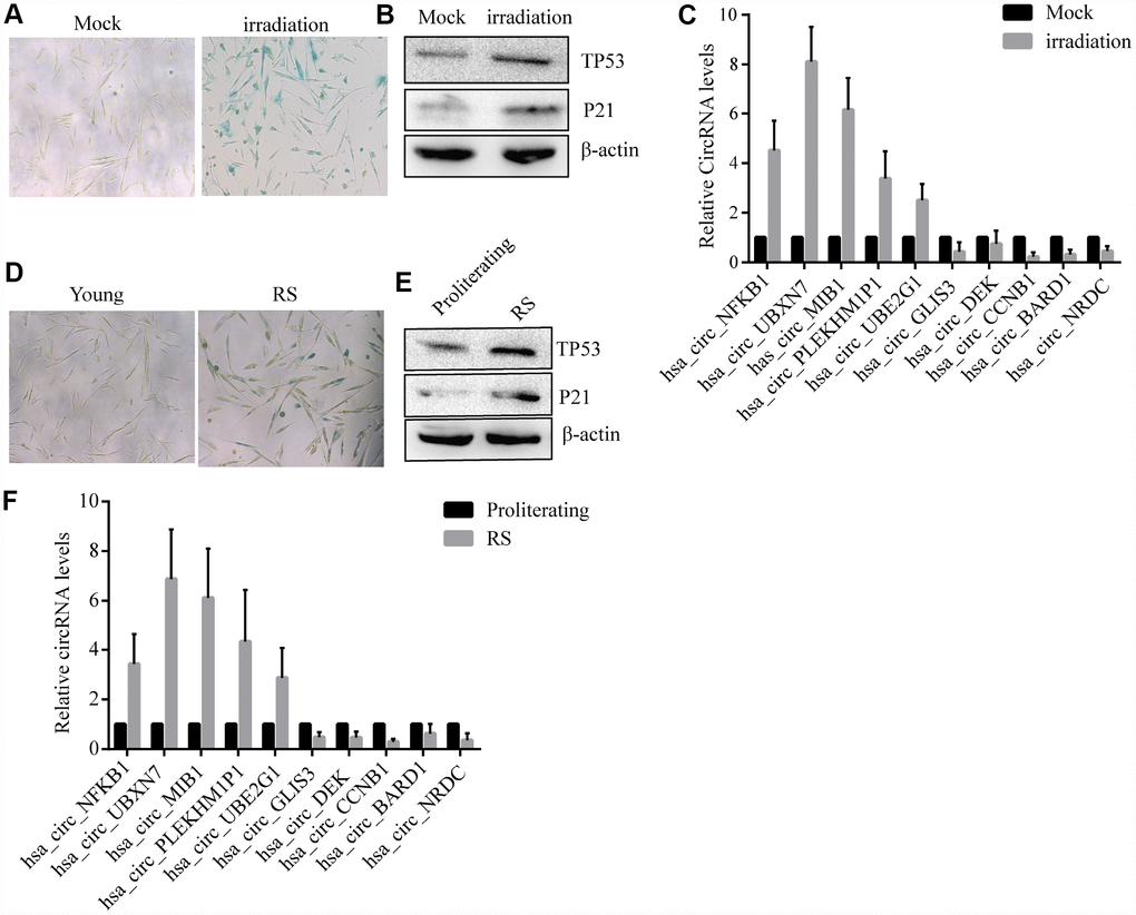 Confirmation of SAC-RNAs expression profiles in prematurely senescent and RS 2BS fibroblasts. (A) Senescence-associated beta-galactosidase (SA-β-gal) staining of in mock-treated (proliferating) and irradiation-induced (prematurely senescent) 2BS cells, bars, 100 μL. (B) Immunoblots analysis of P53 and P21levels in mock-treated and irradiation-induced premature senescent 2BS. (C) Quantitative reverse transcription-polymerase chain reaction (qRT-PCR) analysis of alterations of CircRNA expression in mock-treated and irradiation-induced 2BS cells. (D) SA-β-gal staining of proliferating and RS 2BS cells, bars, 100 μL. (E) immunoblots analysis of the levels of P53 and P21 in proliferating and RS 2BS cells. (F) qRT-PCR analysis of changes in CircRNAs expression in proliferating and RS 2BS cells.