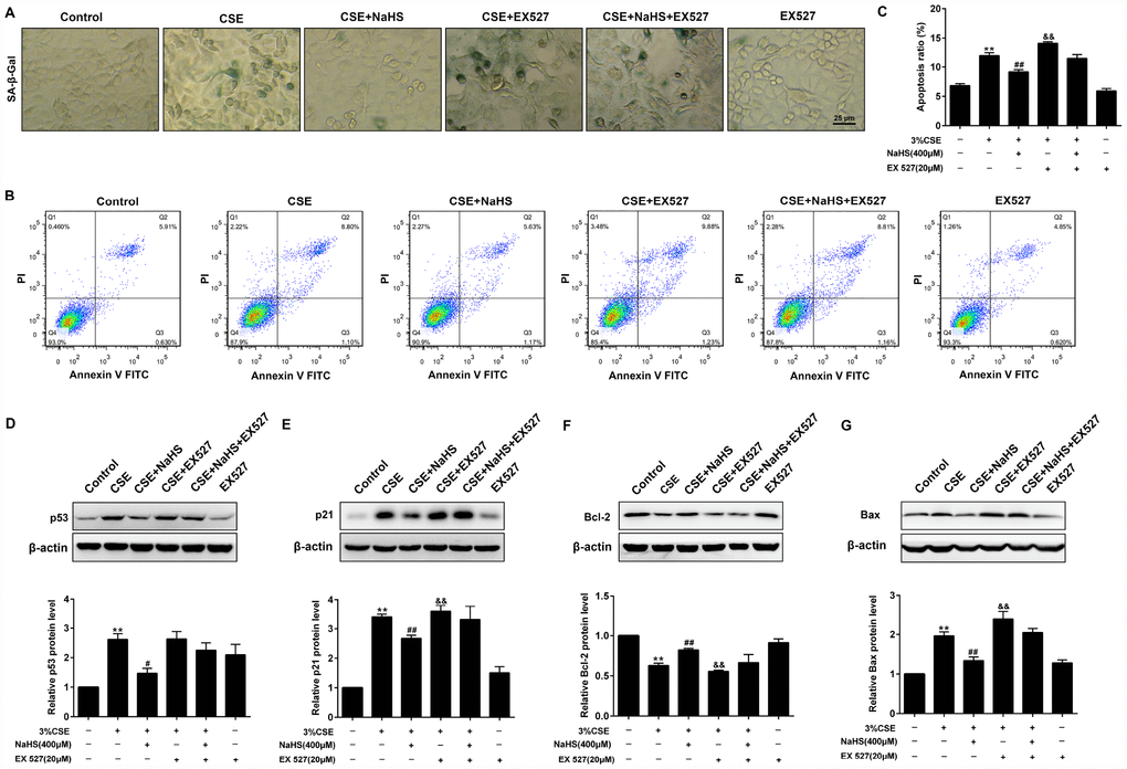 Effects of SIRT1 on the NaHS-mediated cellular senescence and apoptosis in CSE-stimulated A549 cells. A549 cells were cultured with SIRT1 inhibitor (EX527) in the absence and presence of 3% CSE and NaHS for 48 h. (A) Cell senescence was performed by examining the the SA–β-gal activity. (B) The cells were double-stained with Annexin V-FITC and PI, and then the cellular apoptosis was determined by flow cytometry. (C) The ratio of apoptotic cells was statistically analyzed. (D–G) Western blot was used to analyze the protein levels of p53, p21, Bcl-2 and Bax. **P#P##P&P&&P
