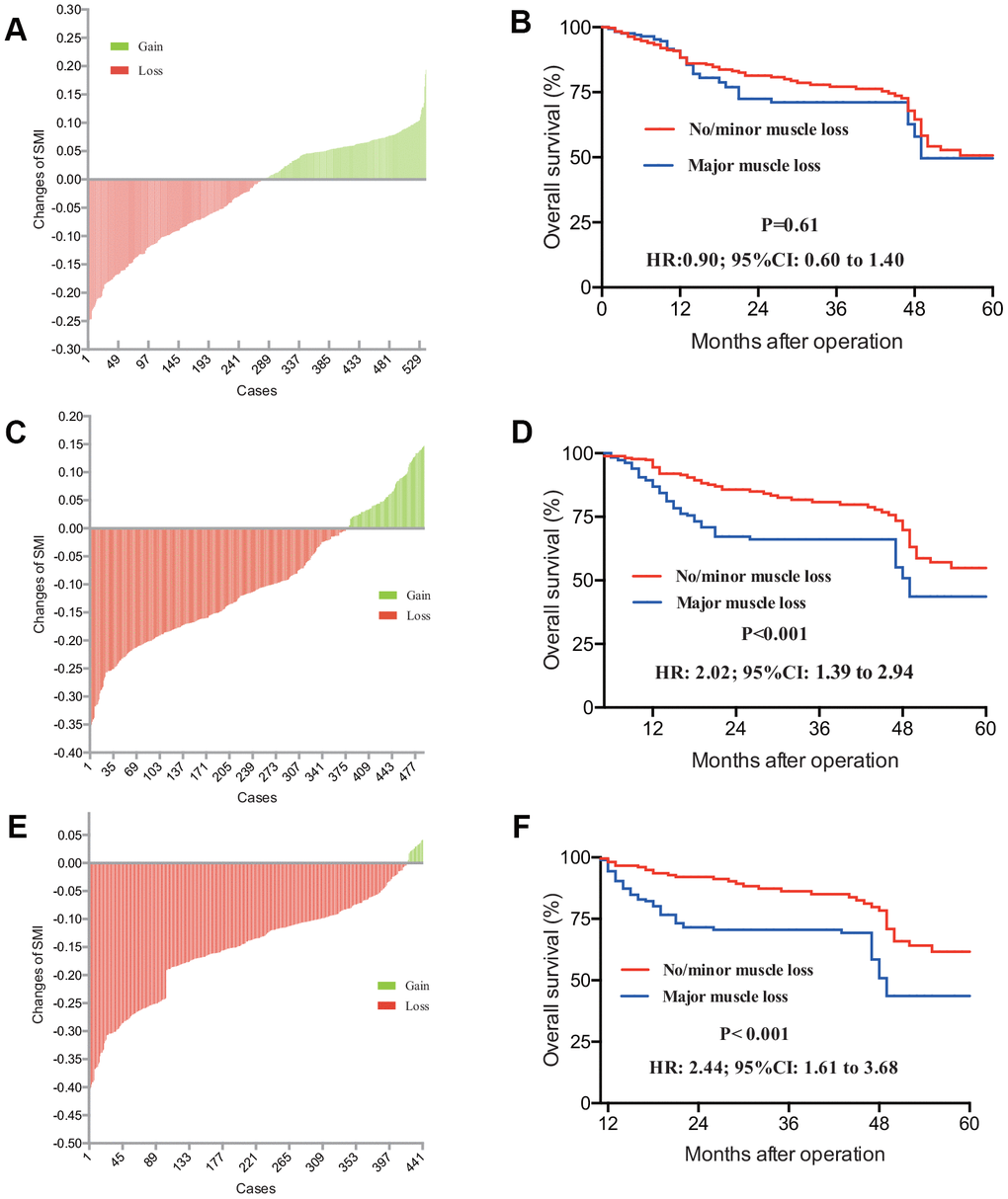 CRLM Patients with gain or loss of SMI was distributed in 3 months (A), 6 months (C) and 12 months’ (E) post-operation. Accordingly, prognostic value of loss of SMI with different post operative CT scan was determined. Patients with different SMI status from 3 months’ (B) scan haven’t demonstrated any survival difference (P=0.061), while patients with different SMI status 6 months’ (D) and 12 months’ (F) SMI results had different survival outcome (P-value