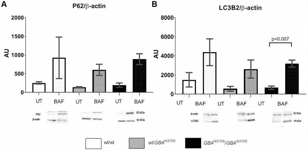 Autophagy flux measurement. Macroautophagy flux showed trends to further increase in the control lines. p62 and LC3-2 levels are similar in the 3 untreated cell lines, however, when autophagy was blocked under bafilomycin treatment, p62 and LC3-2 levels tended to increase the most in controls. The lack of significant differences suggests that preexistent mitochondrial impairment may account for the pathogenesis of GBA mutant neurospheres. AU, arbitrary units; UT, untreated; BAF, bafilomycin. Results are expressed by mean± SEM.