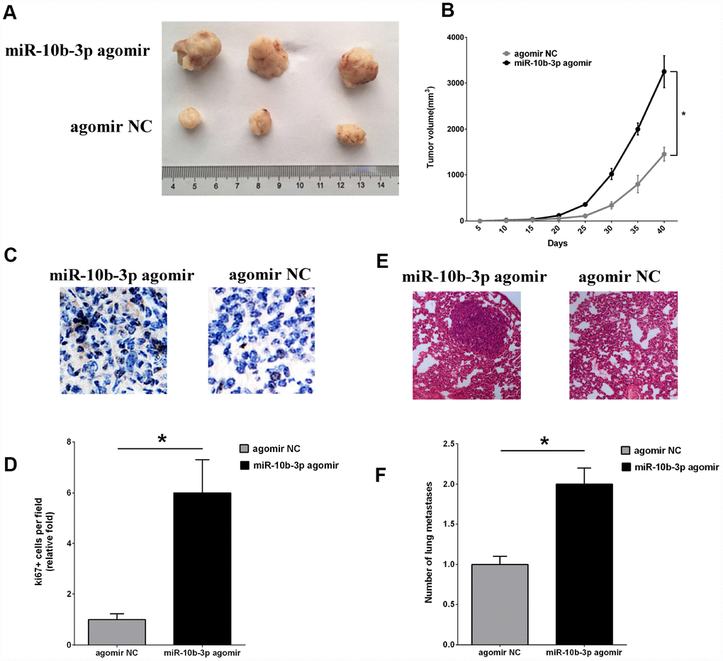 MiR-10b-3p contributes to ESCC tumor growth and metastasis in vivo. (A) An ESCC xenograft model in BALB/c nude mice was constructed using ECA109 cells. MiR-10b-3p agomir or agomir NC was injected into the tumor mass as indicated. After 40 days, tumors that developed were excised and photographed. (B) Tumor volumes were measured every 5 days and plotted. (C and D) To assess cell proliferation, tumor sections were immunostained for Ki-67 and photographed (C), after which Ki-67-positive cells were quantified (D). (E) Representative images of hematoxylin- and eosin-stained metastases in lungs. (F) Quantification of metastatic lung nodules. *P 