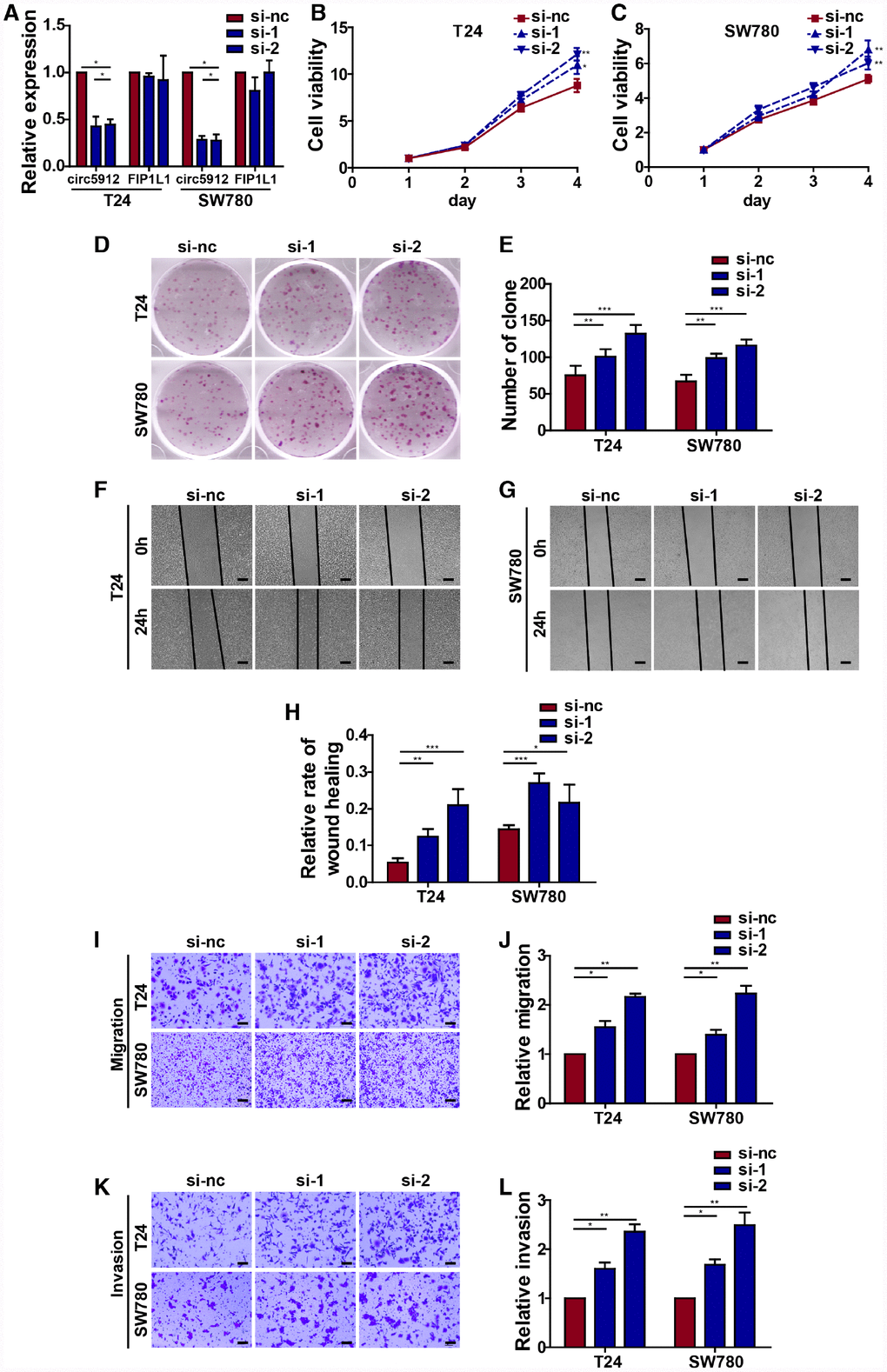 Silencing circ5912 promotes bladder cancer cell growth and metastasis in vitro. Two siRNAs that targeted circ5912 were designed and synthesized. (A) qPCR detected levels of circ5912 and FIP1L1 after treatment with the siRNAs; (B, C) a CCK8 assay was performed to evaluate cell viability; (D, E) a clone forming assay was performed to detect the ability of self-renewal; (F–H) wound healing ability was measured by the distance between the two sides of induced injury after 24 hours, scale bar: 100μm; (I–L) migration and invasion were assessed by counting cells that were able to penetrate the trans-well membrane, scale bar: 25μm.