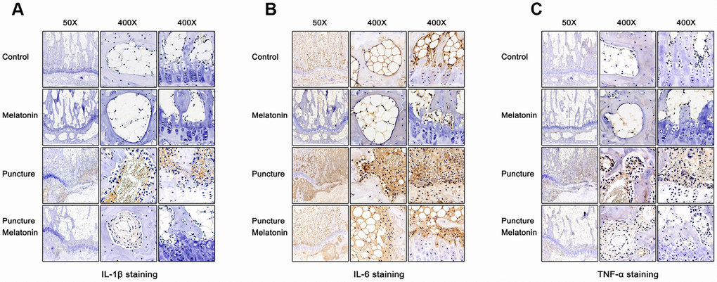 Immunohistochemical staining of each group 8w after puncture. (A) Representative images of IL-1β staining. (B) Representative images of IL-6 staining. (C) Representative images of TNF-α staining.