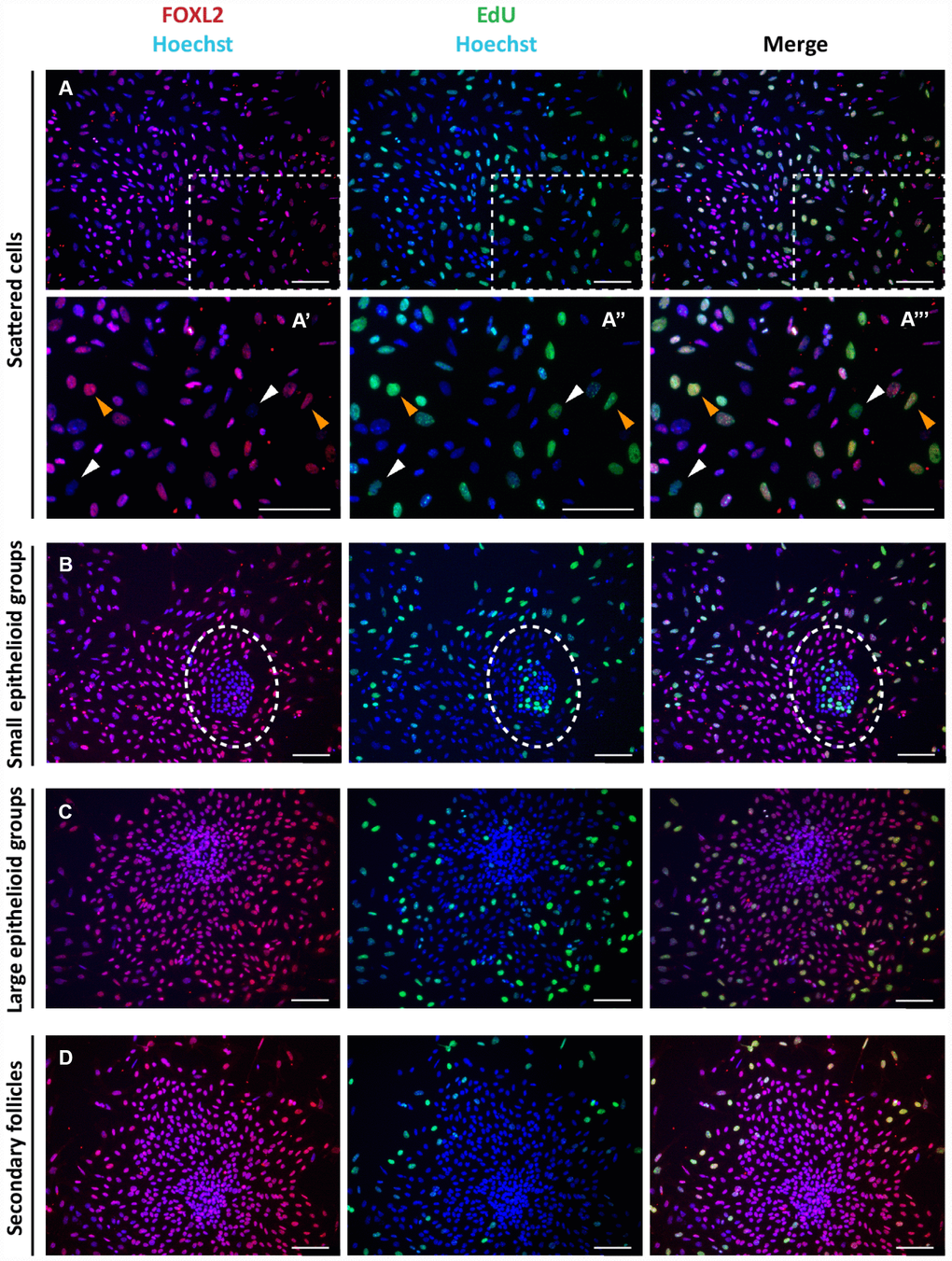 Analysis of proliferation state of cells in culture. Representative double staining for Click-iT EdU (green) and FOXL2 (red) on cultured cells (A–C) and isolated secondary follicles (D) after 24 hrs of culture. Orange and white arrowheads indicate proliferating FOXL2 positive and negative cells, respectively (A’-A’’’ higher magnification images from A). © GCs in large colonies and (D) GCs spreading out from secondary follicles were negative for Click-iT EdU proliferation assay. Scale bar = 100μm.