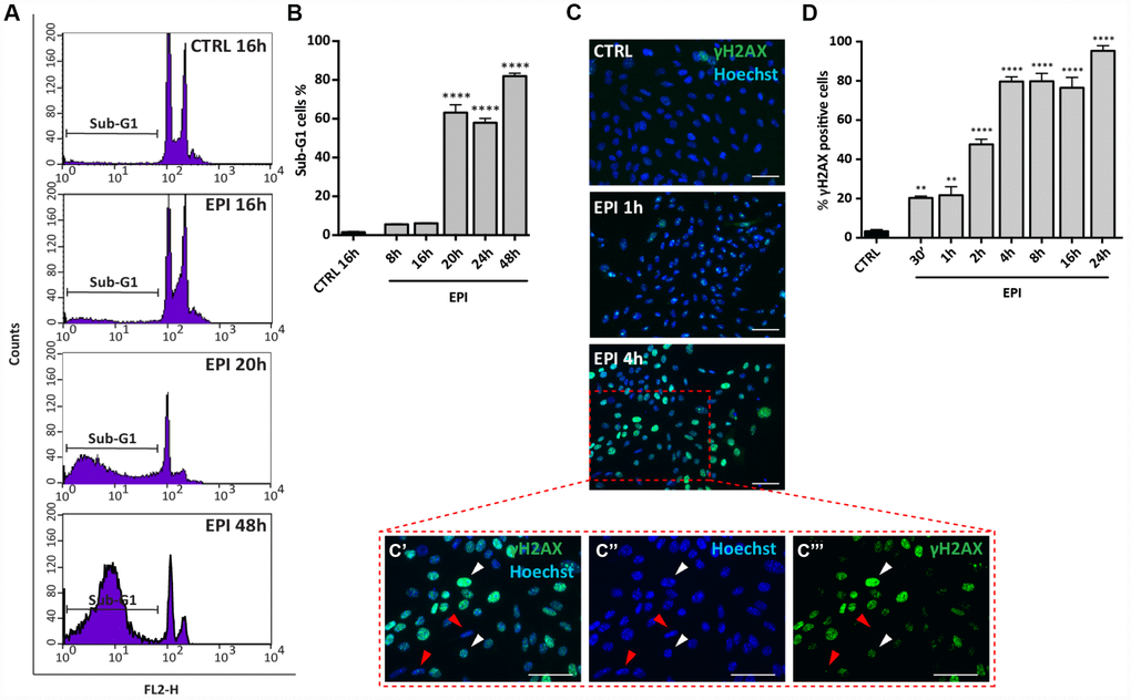 Analysis of EPI-induced apoptosis in ovarian somatic cells. (A, B) Cells treated with 0.5 μm EPI for the indicated times were analyzed by flow cytometry, sub-G1 phase represents apoptotic cells. Data are expressed as mean ± SEM of three different experiments. Statistical differences vs control ****pC’–C’’’ higher magnification images from C). White and red arrowheads indicate γH2AX positive and negative cells, respectively. (D) The graph reports the quantification of γH2AX positive cells percentage scored in three different experiments. Data are expressed as mean ± SEM. Statistical differences vs control **p