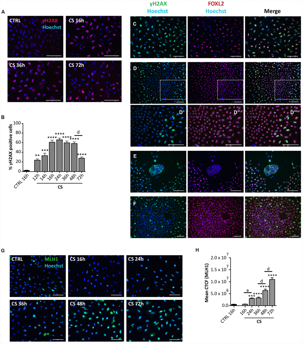 Analysis of CS-induced DNA damage in ovarian somatic cells in vitro. (A) Representative IF of cells stained with γH2AX (red) after 16, 36 and 72 hrs of treatment with 10 μM CS. (B) The graph reports the quantification of γH2AX positive cells percentage. Data are shown as mean ± SEM of three experiments. Statistical differences vs control **pvs CS 72 hrs d = pC–F) Representative double IF for γH2AX (green) and FOXL2 (red) in (C) scattered fibroblastoid and epithelioid cells, (D) a large epithelioid colony (D’–D’’’ higher magnifications from D), (E) a little colony of small epithelioid cells and (F) GCs from isolated secondary follicles after CS-treatment for 24 hrs. Scale bar = 100μm. (G) Representative IF of cells stained with MLH1 (green) after 16, 24, 36, 48 and 72 hrs of treatment with 10 μM CS. Scale bar = 100 μm (H) The graph reports the Mean Correlated Total Cell Fluorescence (CTCF) in ovarian cells treated with/out CS as indicated. The fluorescence intensity was determined in each cell by ImageJ software. Data are expressed as means ± SEM of three experiments. Statistical differences vs control ***pvs CS 24 hrs a = pvs CS 48 hrs d = pvs CS 72 hrs d = p