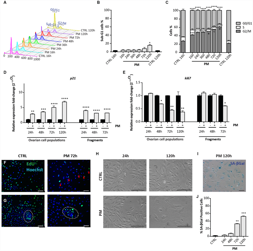 Analysis of PM-induced senescence in ovarian somatic cells. (A–C) Cells treated with 10 μM PM for the indicated time were analyzed by flow cytometry in order to quantify (C) cell cycle distribution and (B) apoptosis (sub-G1). Results are expressed as mean ± SEM of three experiments. Statistical differences vs control **pvs 16hrs in the G2/M phase a = pc = pd = pD, E) Comparison of qRT-PCR for (d) p21 and (e) ki67 between in vitro cultured dispersed ovarian cells and ovarian fragments. Data are shown as mean ± SEM of three analyses. Statistical differences vs control *pF, G) Representative staining for Click-iT EdU (green) in (F) scattered cells and in (G) little colony (white circle) after 72 hrs of treatment with PM. Red arrowheads indicate proliferating cells. Scale bar = 100μm. (H) Cultured ovarian somatic cells acquired large and flattened morphology from 72 hrs of culture with PM. (I, J) Representative image and quantification of cells positive for SA-βgal activity after 120h of PM treatment. Data are expressed as mean ± SEM of SA-βgal positive cells percentage scored in three experiments. Statistical differences vs control **p