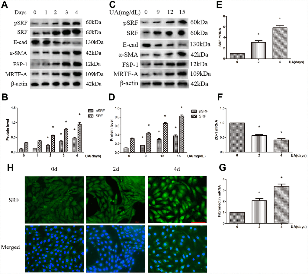 Uric acid (UA) induced epithelial-mesenchymal transition (EMT) and serum response factor (SRF) expression upregulation in NRK-52E cells. (A) Western blot analysis showing that UA (15 mg/dL) mediated the upregulation of phosphorylated SRF (pSRF), SRF, α-smooth muscle actin (α-SMA), and Fibroblast specific protein-1 (FSP-1) expression and the downregulation of E-cadherin expression in a time-dependent manner. (C) Western blot analysis showing that UA mediated the upregulation of pSRF, SRF, α-SMA, and FSP-1 expression and the downregulation of E-cadherin expression in a dose-dependent manner at 48 h. (B, D) Quantitative determination of relative SRF levels. (E–G) Quantitative RT-PCR analysis of SRF, ZO-1 and fibronectin (FN) mRNA expression. (H) Immunofluorescence staining for SRF at an original magnification of 400×. *P