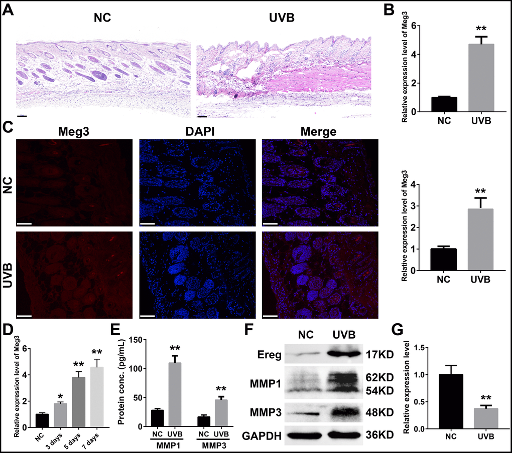 (A) H&E staining of murine dorsal skin samples with or without UVB irradiation (scale bar = 100 μm). (B) Quantification of Meg3 expression by qRT-PCR in normal and UVB irradiated murine dorsal skin tissues. (C) Fluorescence in situ hybridization (FISH) of Meg3 in normal and UVB irradiated murine dorsal skin tissues. (D) Quantification of Meg3 expression by qRT-PCR after different exposure time of UVB irradiation. (E) Quantification of secreted MMP1 and MMP3 by ELISA in normal and UVB irradiated murine dorsal skin tissues. (F) The expression level of Ereg, MMP1, MMP3 by WB in normal and UVB irradiated murine dorsal skin tissues. (G) Quantification of miR-93-5p expression by qRT-PCR in normal and UVB irradiated murine dorsal skin tissues.