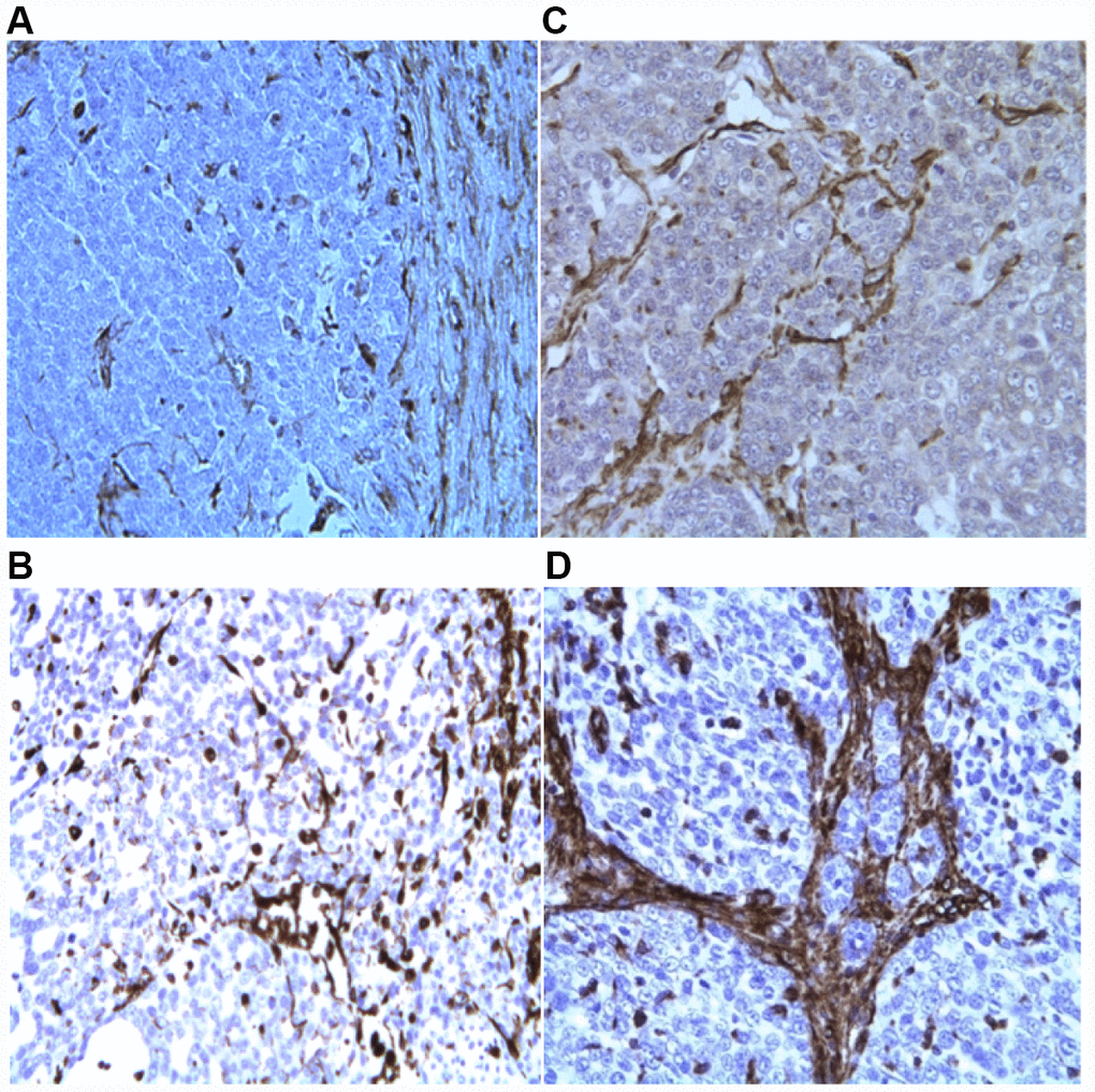 IHC evaluation of Col 1 (A, C) and Col 3 expression (B, D) in tumor biopsies, before (A, B) and after (C, D) p62 DNA injections (20×).