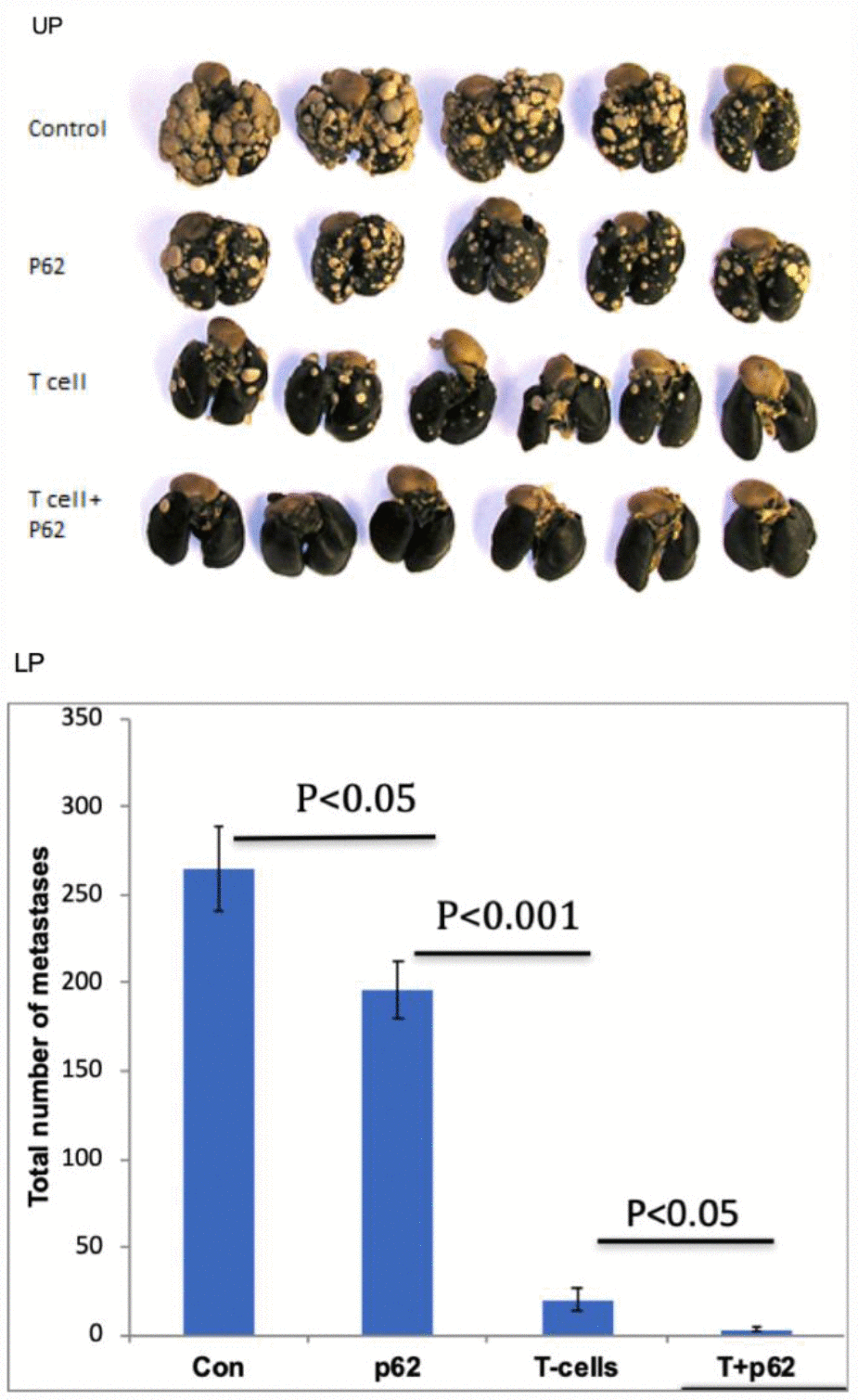 Effect of p62 plasmid on adoptive T-cell transfer. Upper panel (UP): lung metastases formed 26 days after i.v. injection of MCA205 fibrosarcoma cells; Lower panel (LP): results quantification.