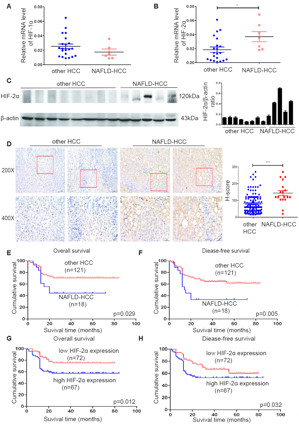 HIF-2α was upregulated in NAFLD-HCC patients and correlated with poor survival. (A, B) Quantitative RT-PCR assessment of HIF-1α and HIF-2α expression in tissues from NAFLD-HCC patients (n=7) and other HCC patients (n=21). Transcription levels were normalized to those of β-actin. (C). Western blot analysis of HIF-2α expression in the patients’ tissues. β-Actin was used as the loading control. Densitometric analyses of the band intensity ratios for HIF-2α/β-actin. (D) IHC determination of HIF-2α expression in tissues from HCC and NAFLD-HCC patients (magnification: 200X, 400X). H score between NAFLD-HCC and HCC (E, F) Survival curves of 139 patients with HCC and NAFLD-HCC. (G, H) Survival curves of 139 patients stratified according to HIF-2α protein expression.