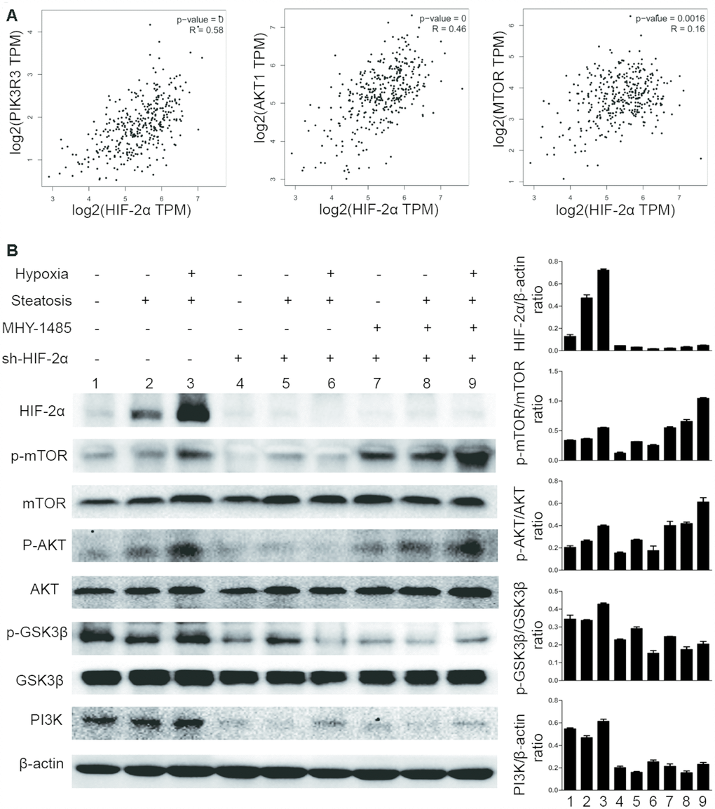 Hypoxia-mediated upregulation of HIF-2α expression activates mTOR signalling pathways. (A) Pearson correlation analysis of the correlation between HIF-2α expression and relative genes in the patients with liver hepatocellular carcinoma (LIHC) from the TCGA database (http://gepia.cancer-pku.cn). (B) Western blot analysis of HIF-2α expression and expression of PI3K-AKT-mTOR pathway factors in HCC and steatotic HCC under hypoxic conditions. β-Actin was used as the loading control. Densitometric analyses of the band intensity ratios for HIF-2α/β-actin, PI3K/β-actin, p-GSK3β/GSK3β, p-AKT/AKT and p-mTOR/mTOR.