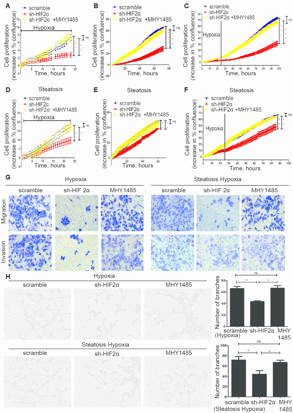 Steatotic HCC growth, migration, invasion and angiogenesis in a hypoxic microenvironment needs HIF-2α. (A–C) Summary graph showing the HCC cell 2D growth rate in hypoxic conditions (A), after 24 hypoxia treatments (B) and all conditions (C). (D–F) Summary graph showing the steatotic HCC cell 2D growth rate under hypoxic conditions (D) after 24 hypoxia treatments (E) and all conditions (F, G). Transwell assays of HCC, HIF-2α-KD HCC, steatotic HCC and HIF-2α-KD steatotic HCC cells under hypoxic conditions in the presence or absence of MHY1485 treatment. h. Representative images of HUVEC tube formation; HUVECs were treated with the supernatant of HCC, HIF-2α-KD HCC, steatotic HCC and HIF-2α-KD steatotic HCC cell cultures.