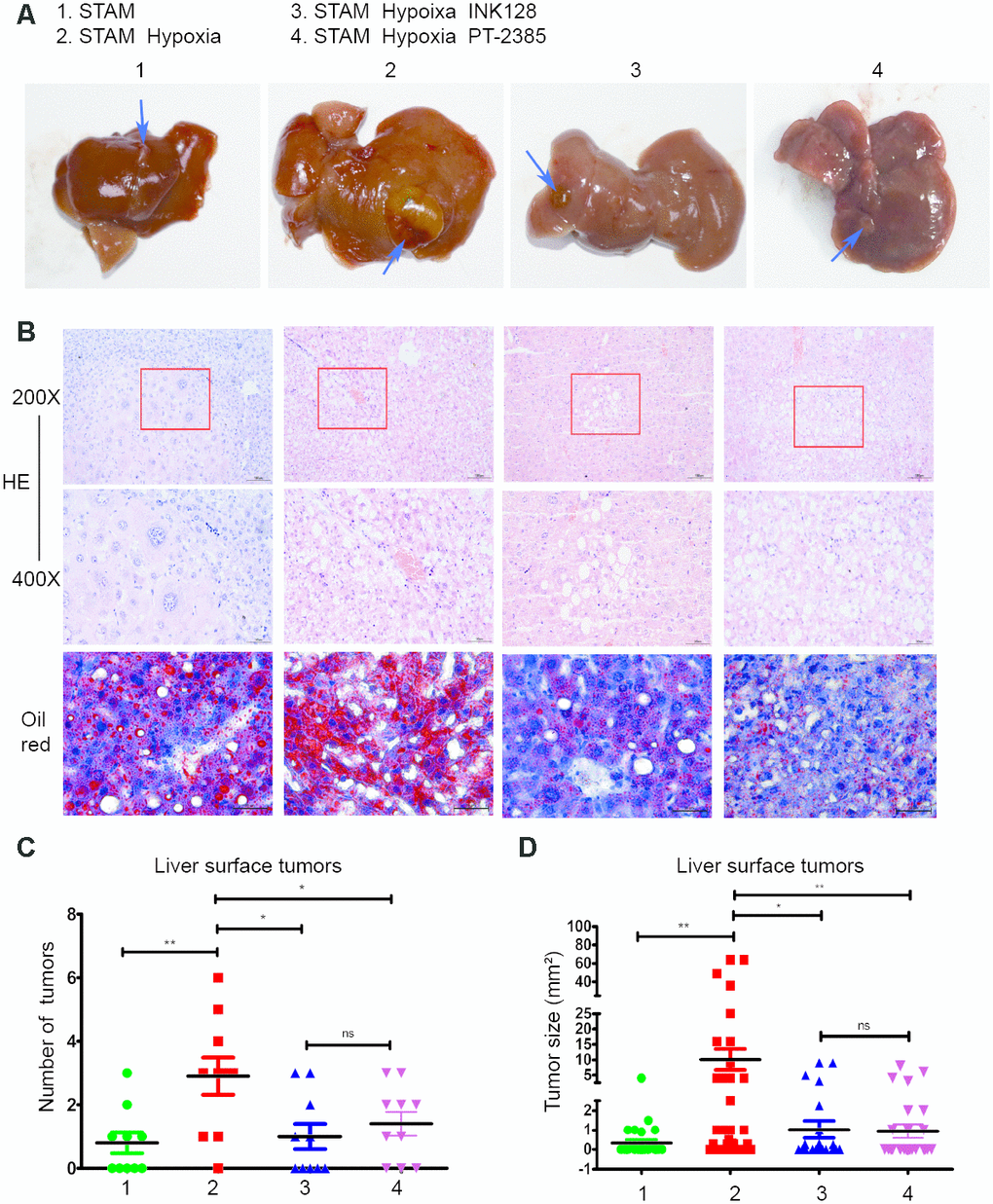 Hypoxia-induced HIF-2α overexpression promotes STAM mouse tumour development and lipid accumulation in vivo, which can be rescued by an mTOR inhibitor. (A). Gross specimens from STAM mice of different groups. (B) Images of liver stained by HE and Oil red O staining. (C) The numbers of tumours on the liver surface of different STAM mice (n = 10 mice/group). d. In the tumour size analysis, the largest three tumours found at a random location in the liver were used.